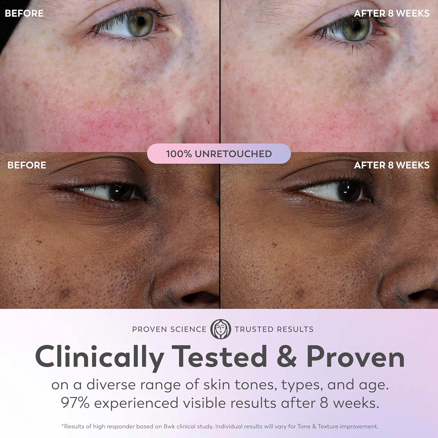 Olay Super Serum 11.34 g - Niacinamida, Vitamina C, AHA