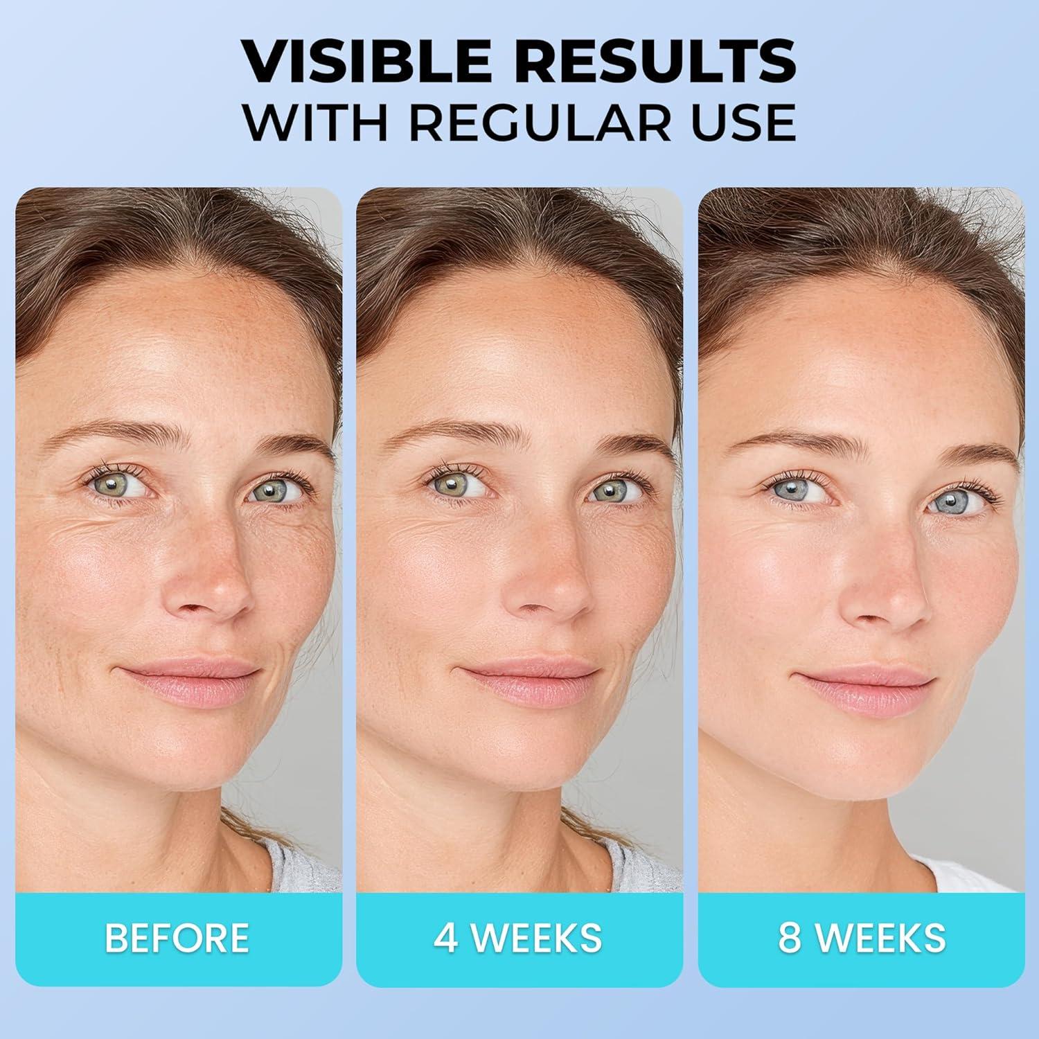 Hidratante Facial Vitalysin 50.3 ml Antiarrugas Piel Madura