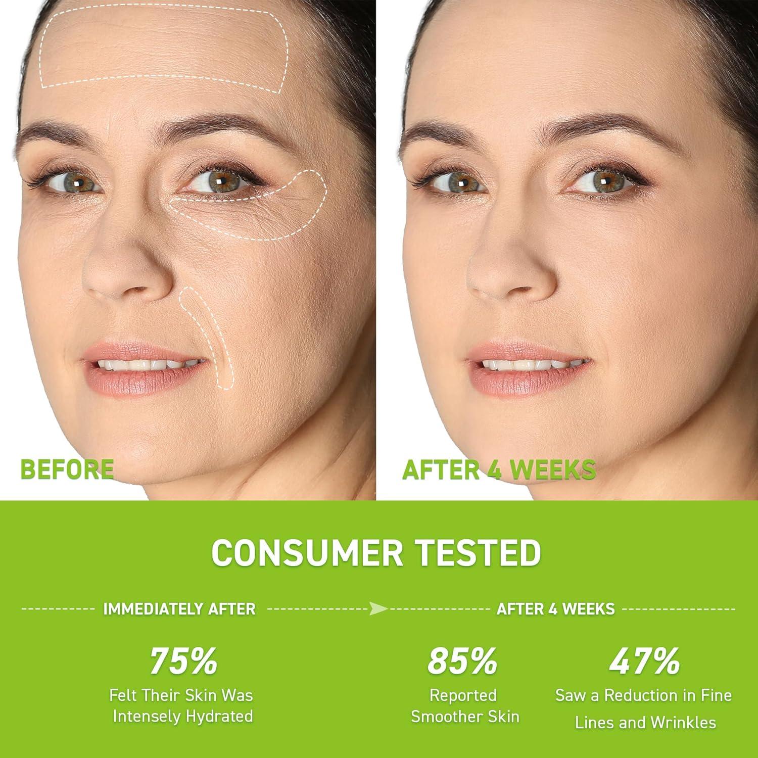 Suero Antiarrugas Retinol Enaskin 29.57 ml Hidratante