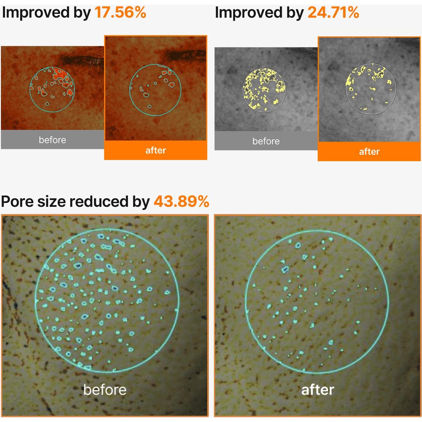 Mascarilla Facial Iluminadora Pore+Dark Spot 4EA - K-Beauty