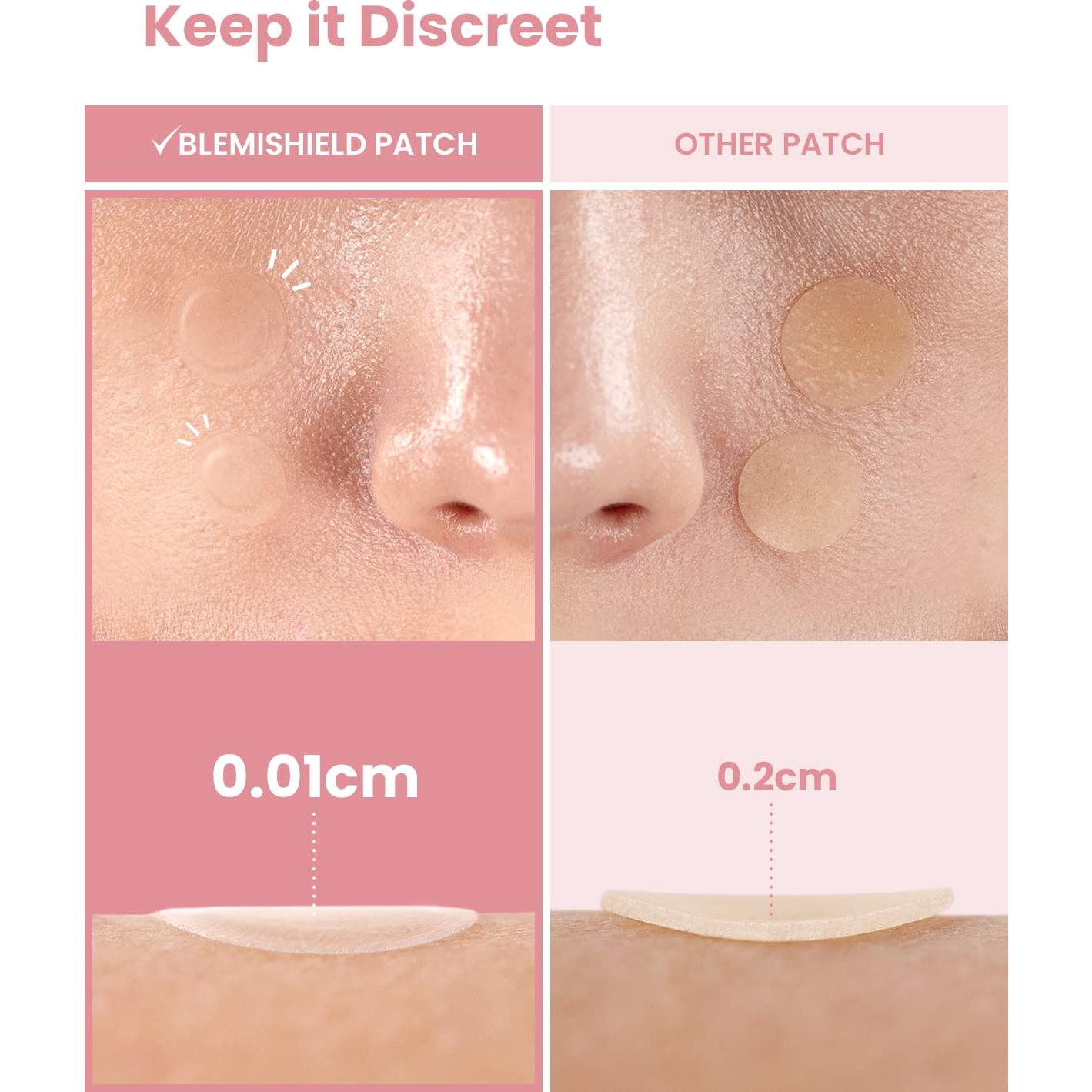 Parches para Granos Hydrocolloid Glam Up 180 Piezas 10mm/12mm