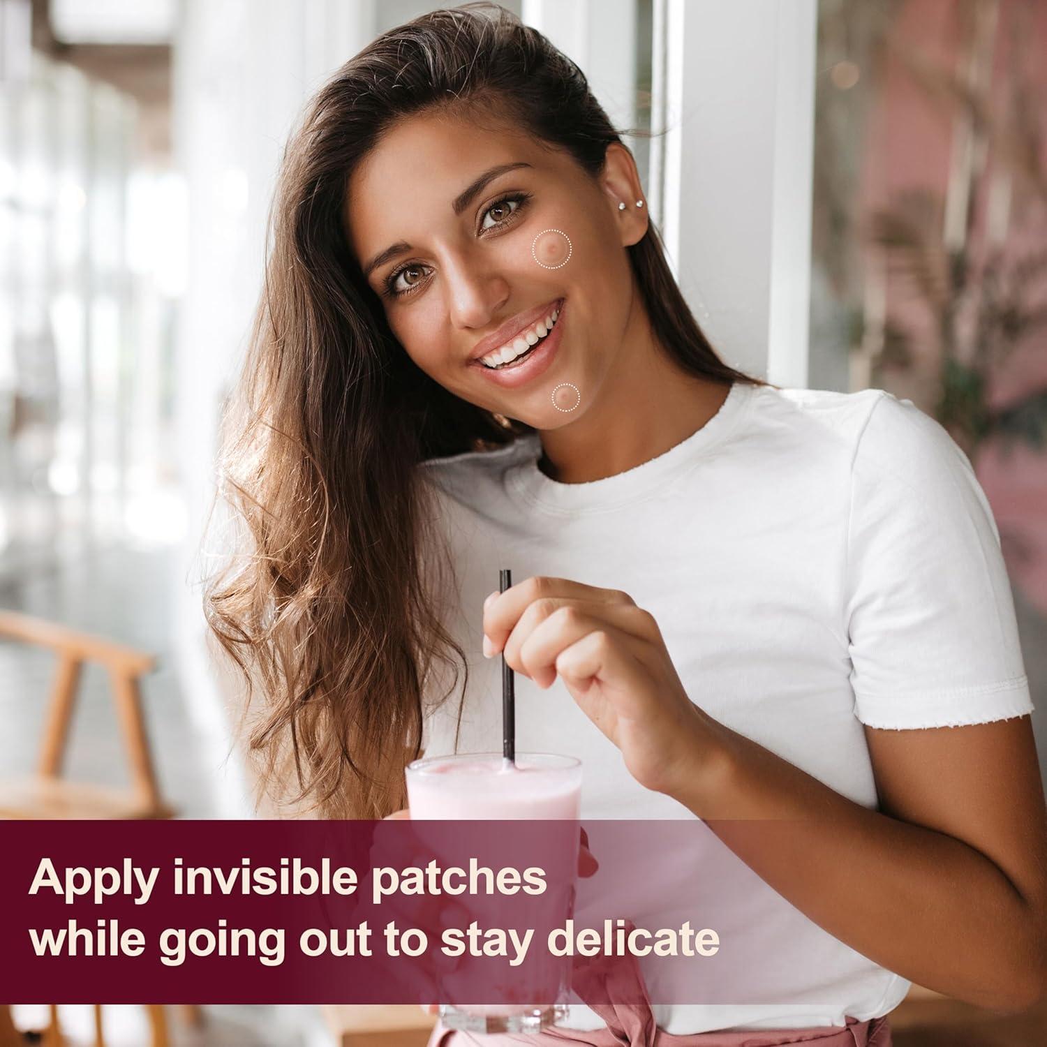 Parches para Granos Hidrocoloides Shivrise - 300 Unidades, 4 Tamaños