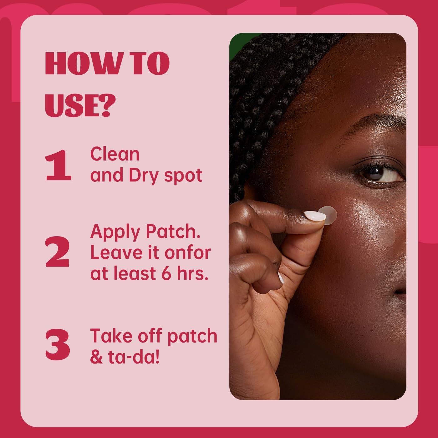 194 Parches Hidrocoloides para Acné Materasu - 192+2 Parches