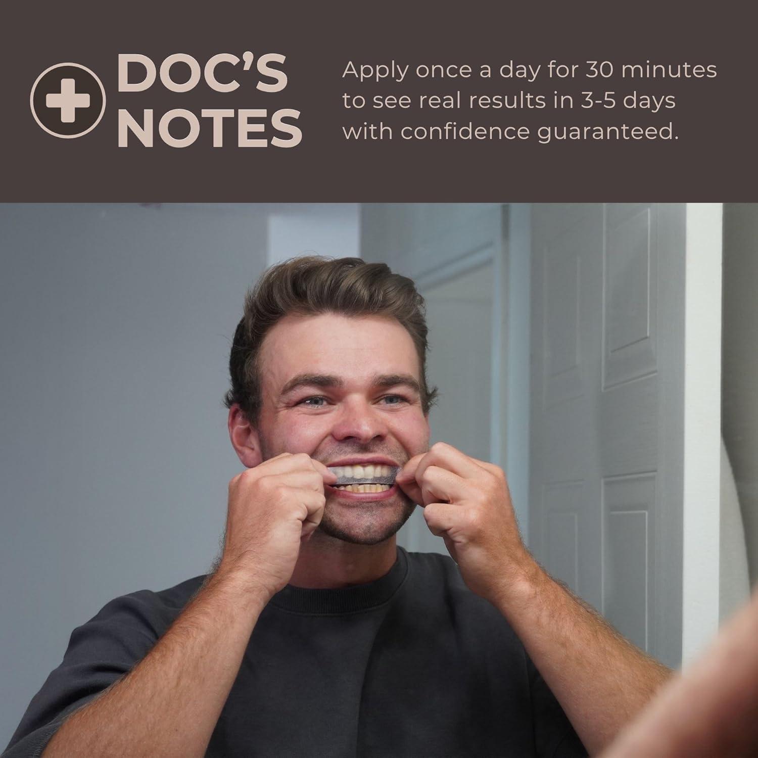 Tiras Blanqueadoras de Dientes GNAW LABS - 14 Tratamientos con Peróxido