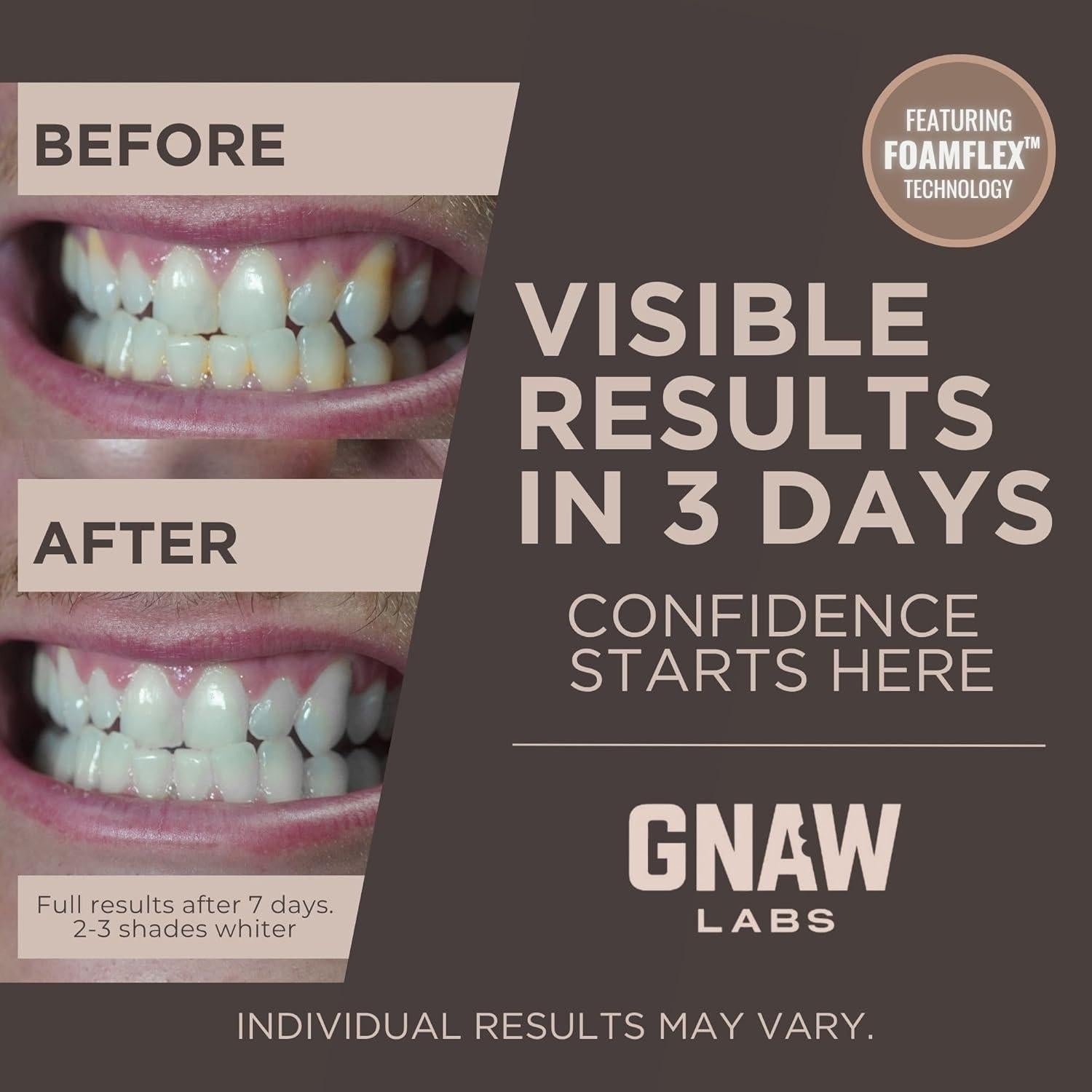 Tiras Blanqueadoras de Dientes GNAW LABS - 14 Tratamientos con Peróxido