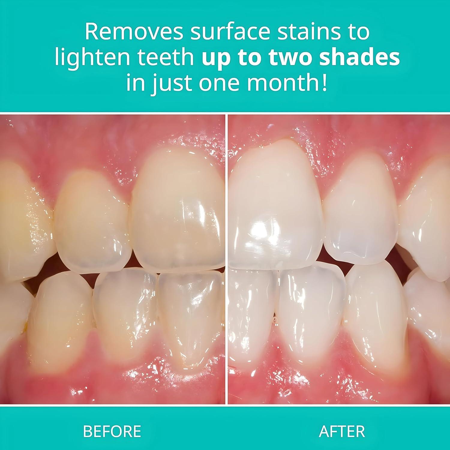 Tiras Blanqueadoras Opalescence Go - 12 Tratamientos + Pasta 1 oz