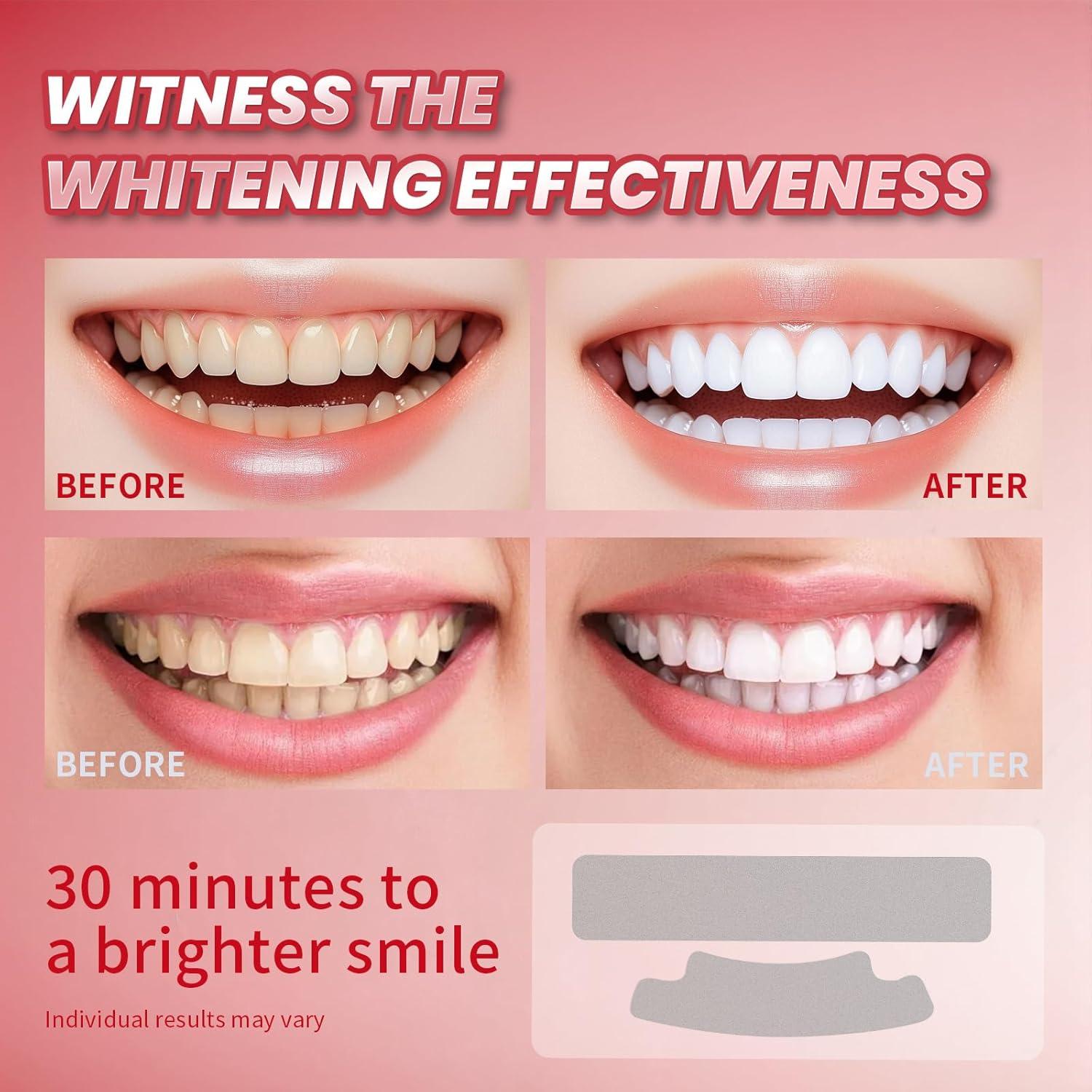 Tiras Blanqueadoras de Dientes Lanlwos 28 Unidades Sensibles