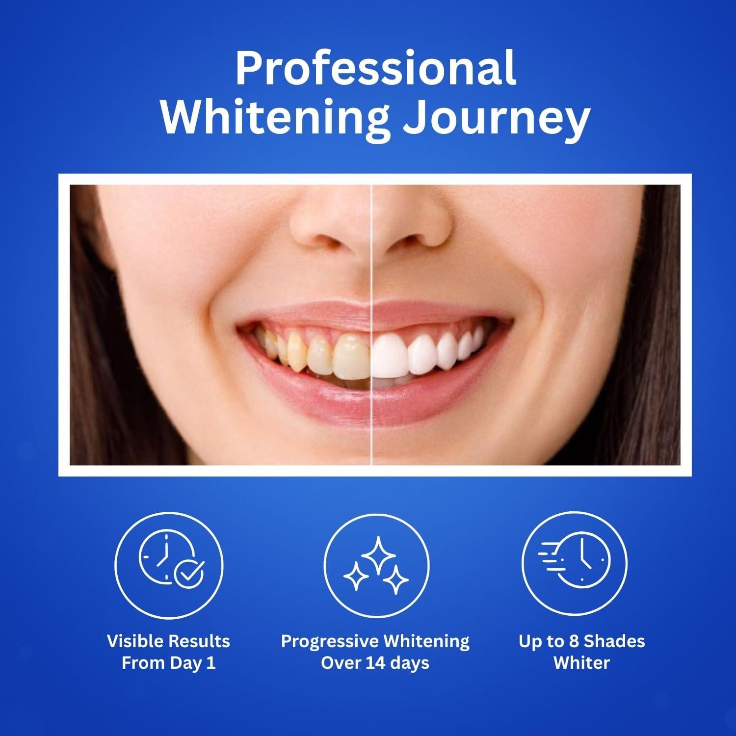 Tiras Blanqueadoras de Dientes Shen Plus - 14 Tiras Naturales