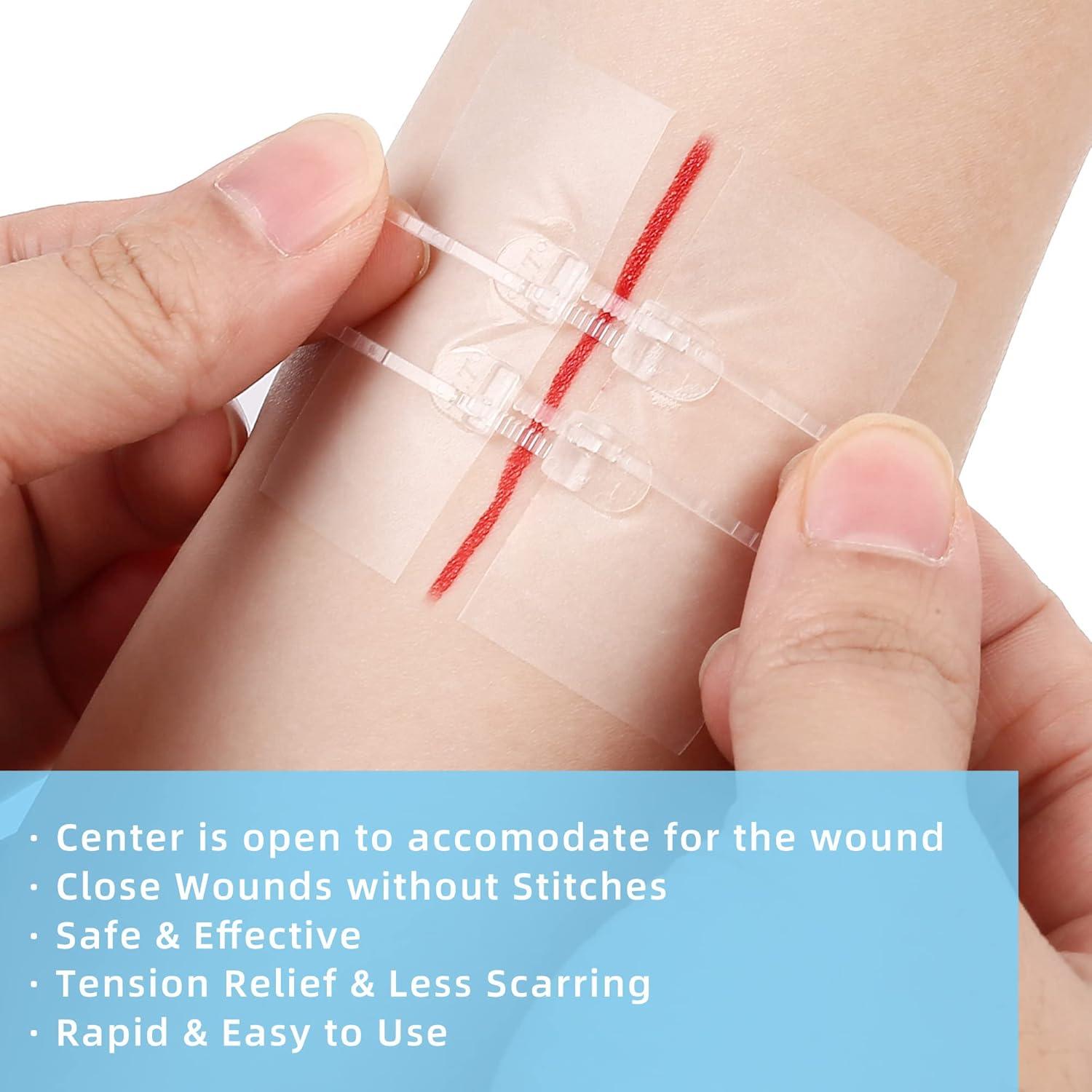 Cierres de Heridas LotFancy 4 Unidades Estériles Primeros Auxilios