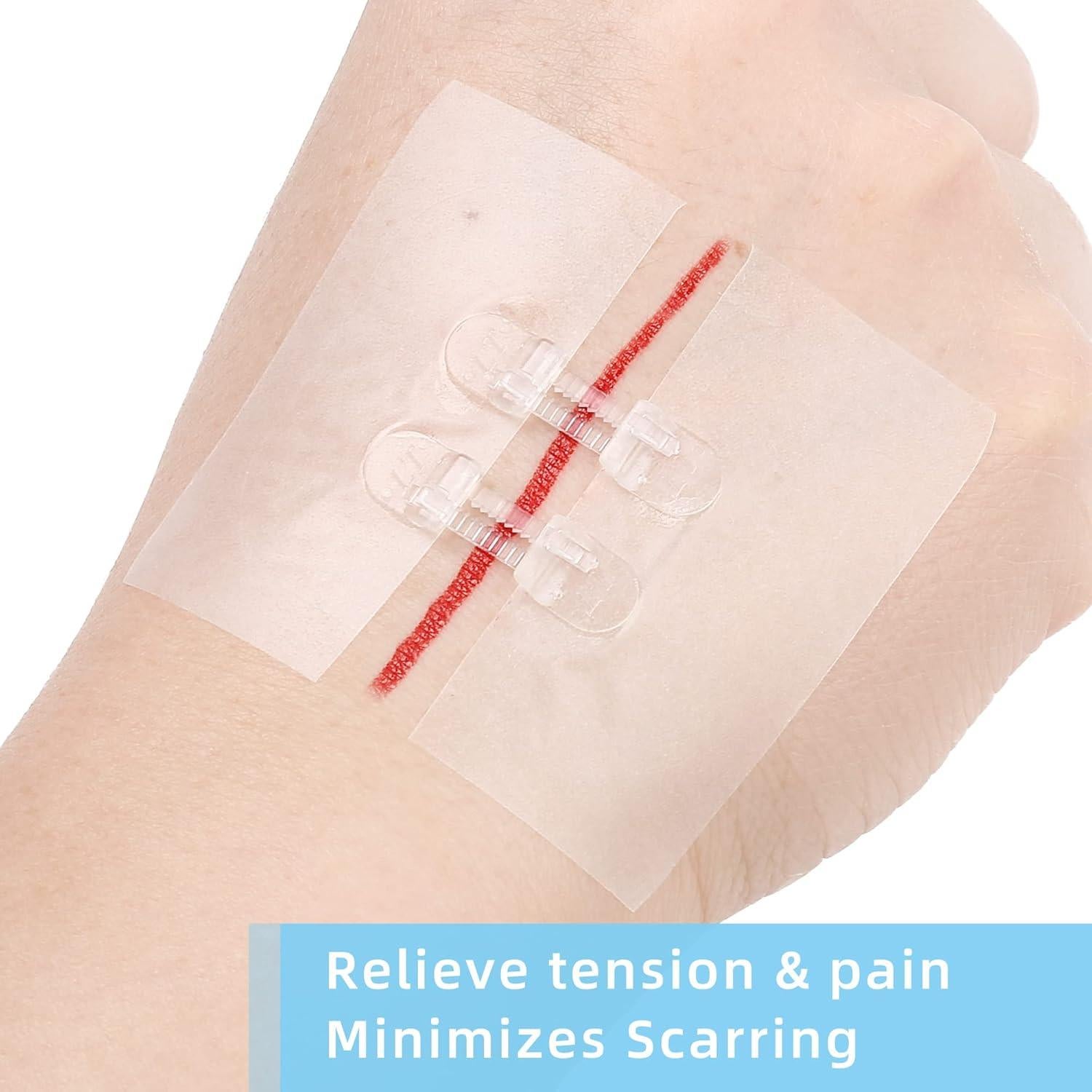 Cierres de Heridas LotFancy 4 Unidades Estériles Primeros Auxilios