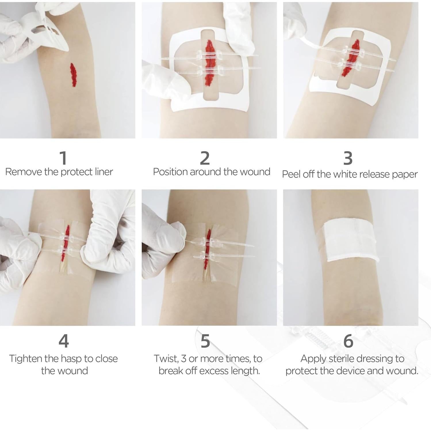 Cierres de Heridas LotFancy 4 Unidades Estériles Primeros Auxilios