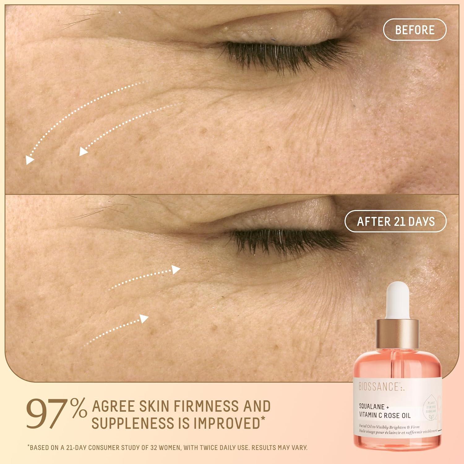 Conjunto de Cuidado de Piel Biossance - Aceite de Rosa y Labios