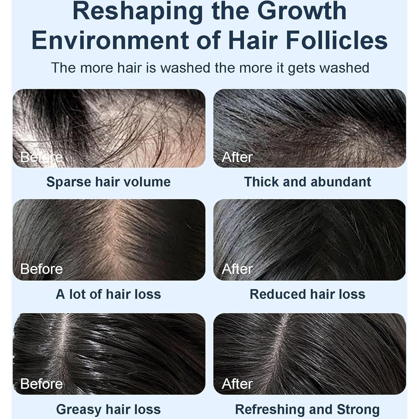 Champú Orgánico Tgideas con Biotina y Romero 570g - Anti-Pérdida