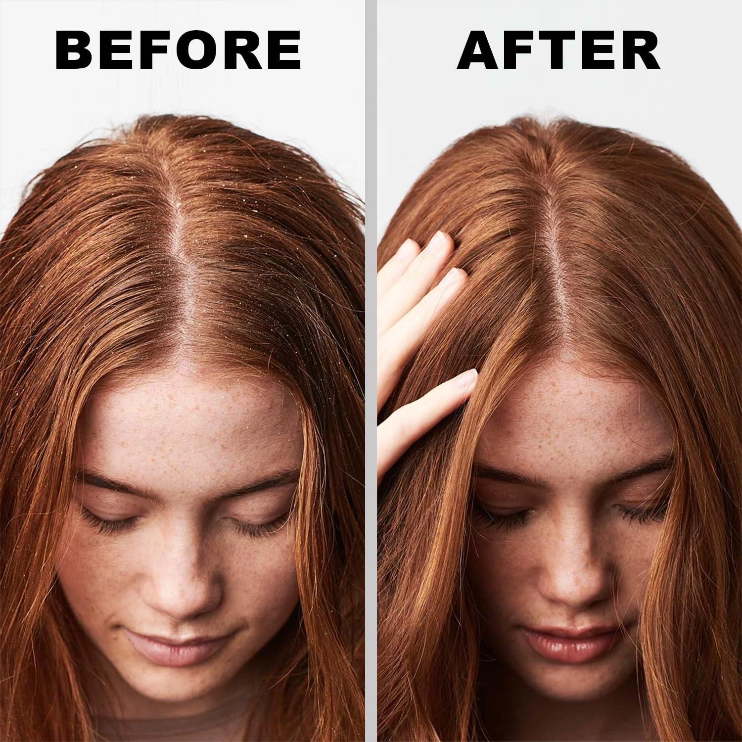 Champú Seco Voluminizador YU KUI LX para Cabello Claro 159g