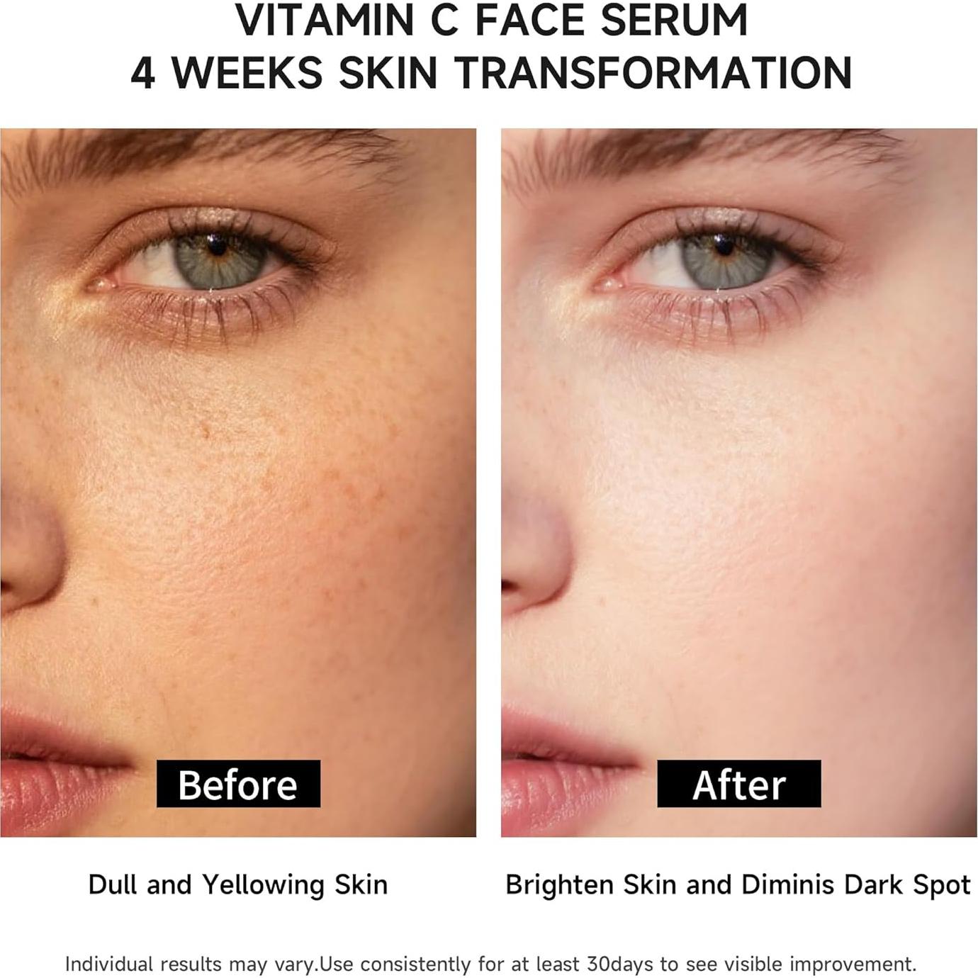 Suero Facial BACHERI Vitamina C y Ácido Hialurónico 15 Ampollas