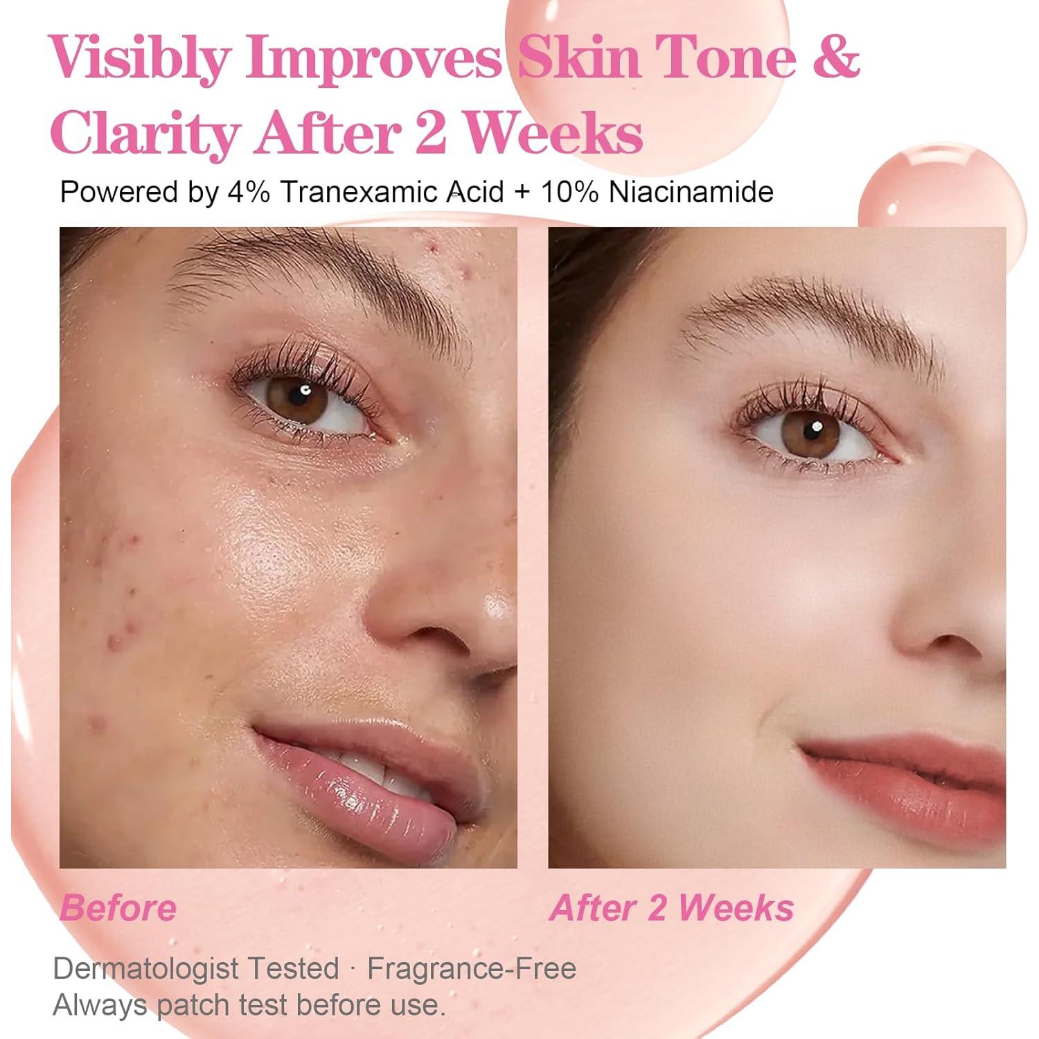 Suero Facial Hidratante SKSOYT 30ml - Niacinamida 10% + TXA 4%