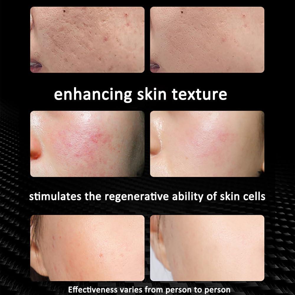 Lámpara Terapia Luz Roja U4GLORY 18 LEDs 660/850nm Ajustable