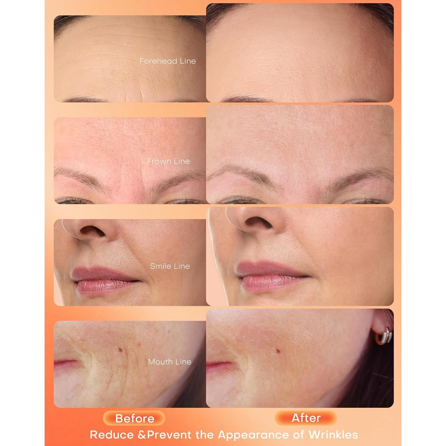 Máscara de Terapia de Luz Roja NEWKEY LED 7 Colores Facial