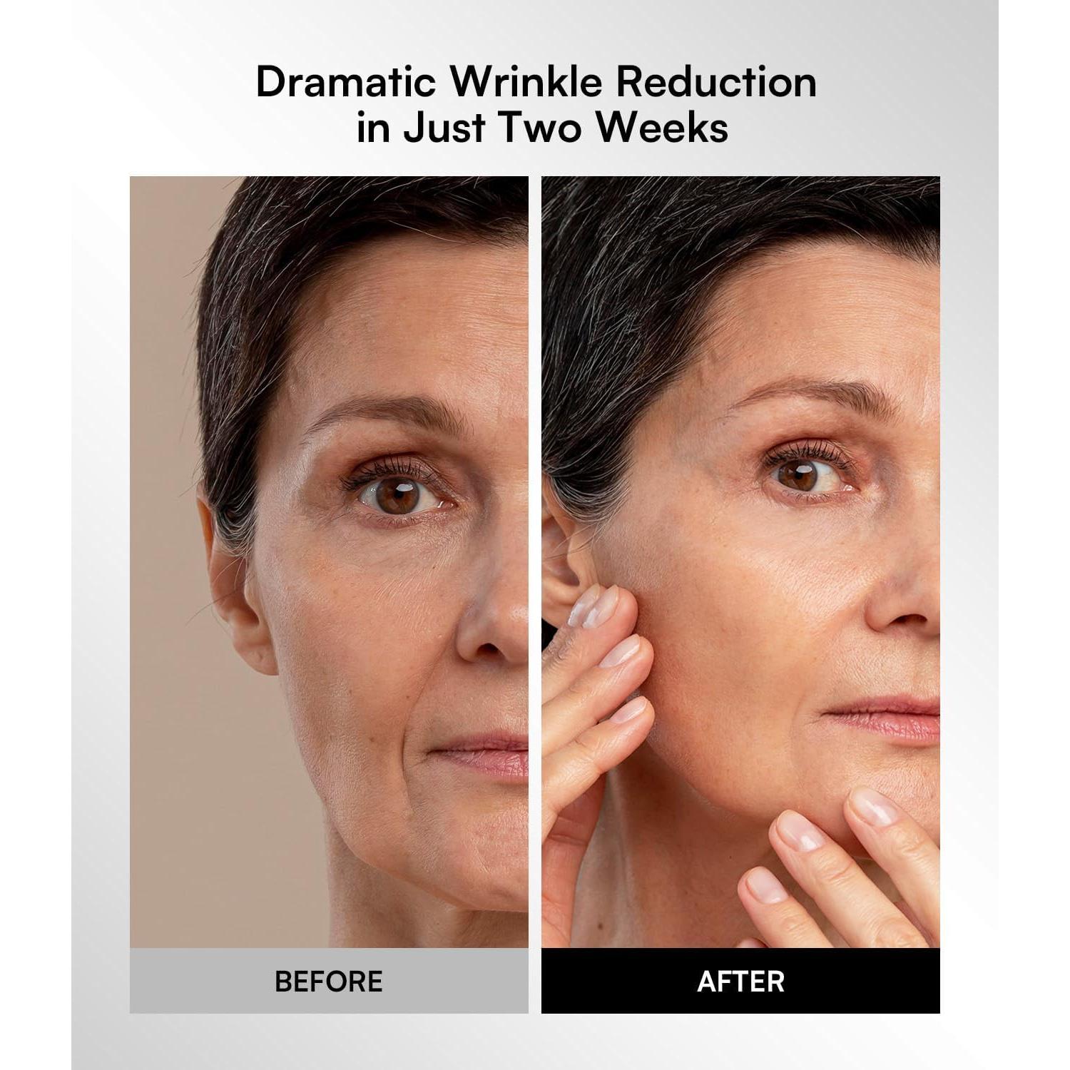 Máscara de Luz Roja INIA Inalámbrica para Cuidado Facial