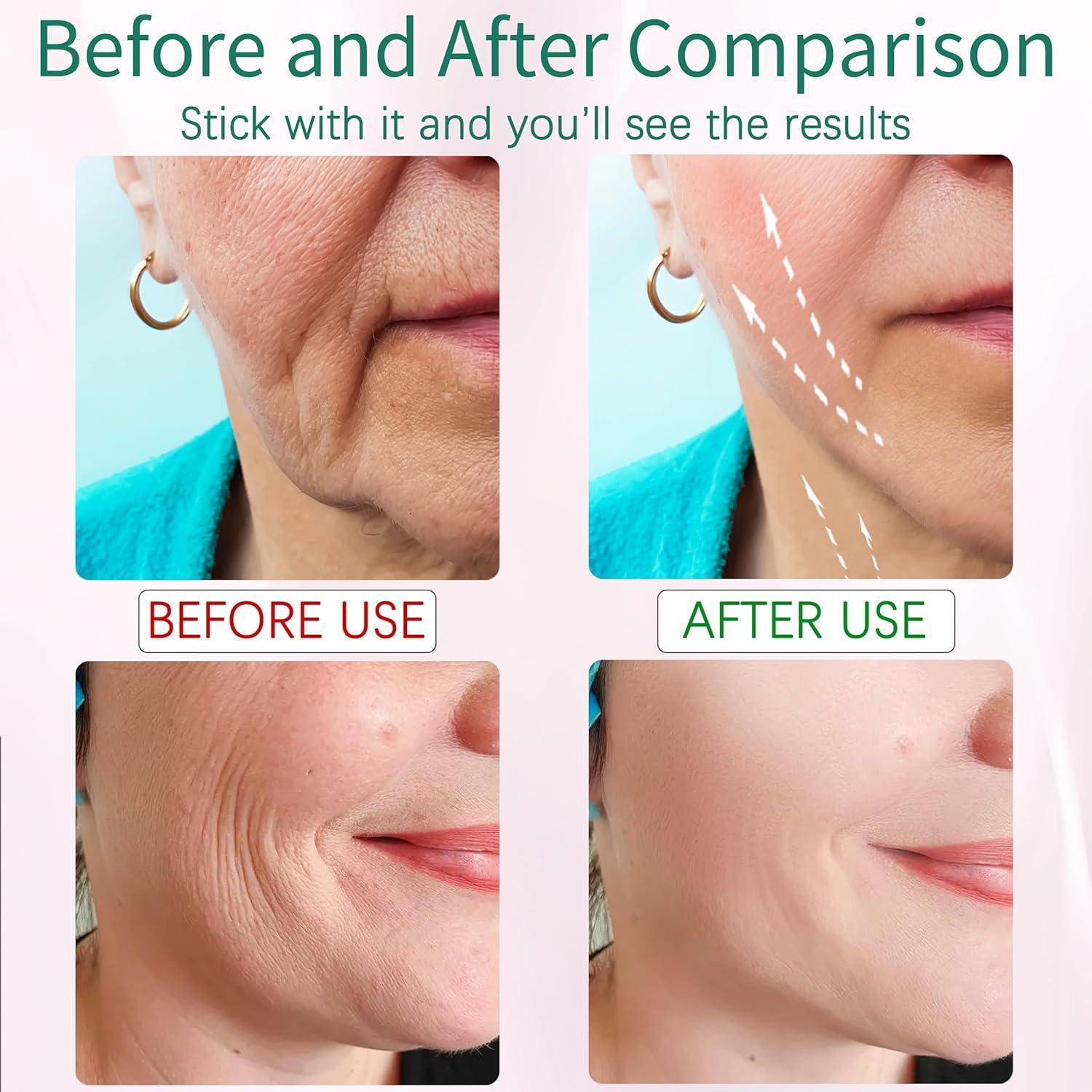 Masajeador Facial XMXW 7 Colores Calentamiento 160°