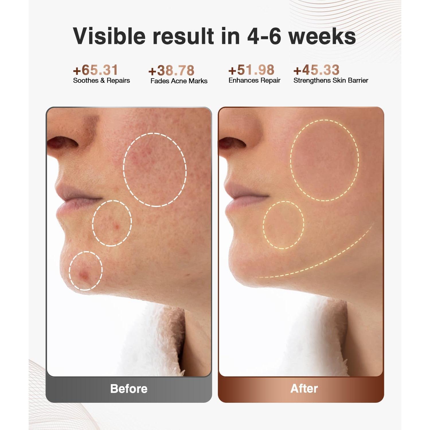 Terapia de Luz Roja JOVS para la Cara - Dispositivo LED Inalámbrico