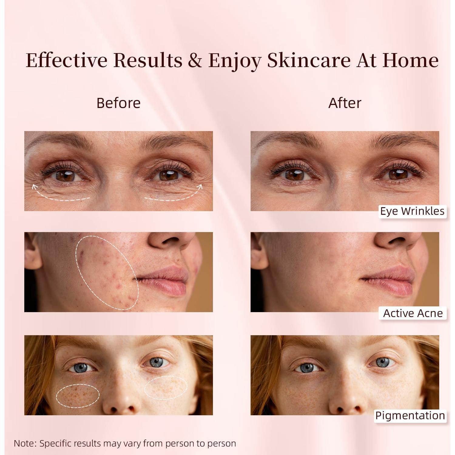 Máquina de Terapia de Luz LED MOLAMOYA 8 en 1 para Cara y Cuerpo