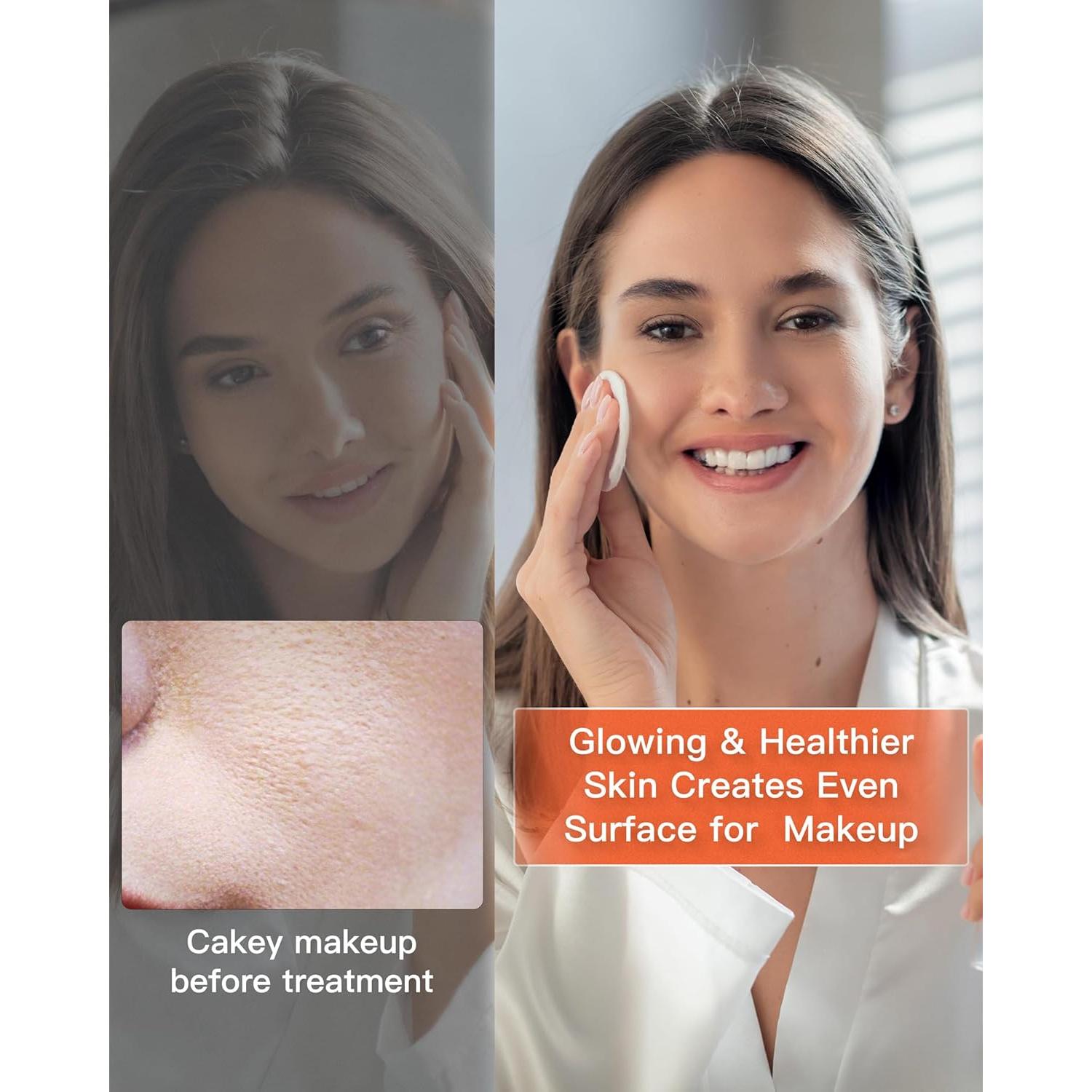 Máscara Facial LED NEWKEY Terapia Luz Roja y Azul 150 LEDs