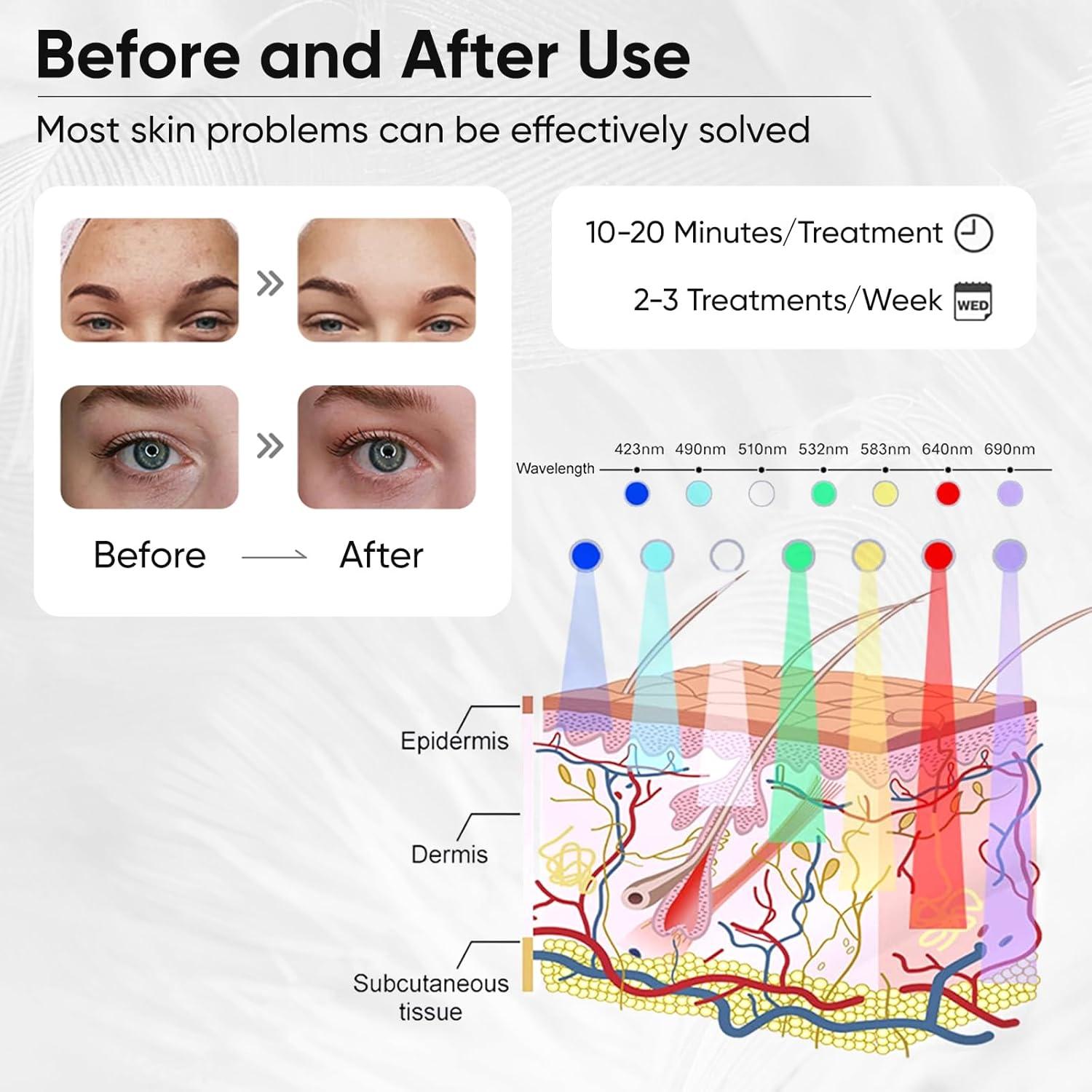 Máscara de Luz LED Terapia Roja y Azul Beimei BM-008 19x26cm