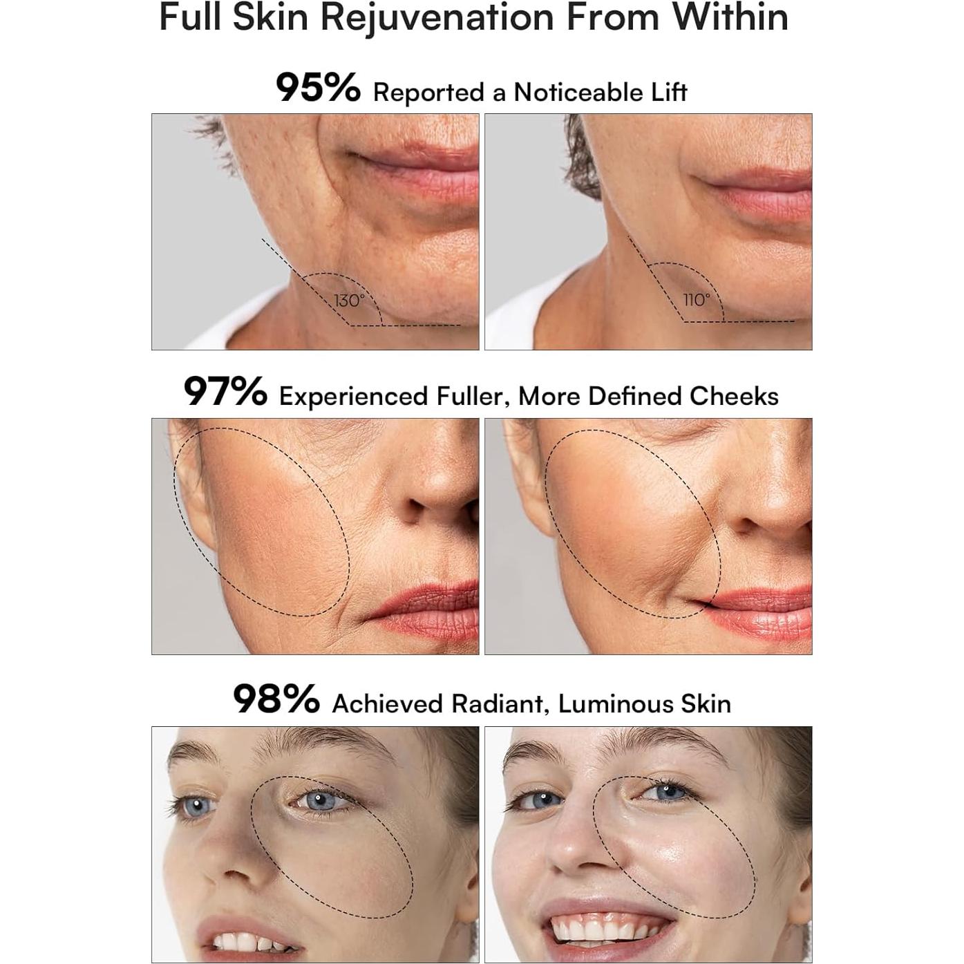 Dispositivo Facial INIA 3 en 1 Luz Roja y Masajeador