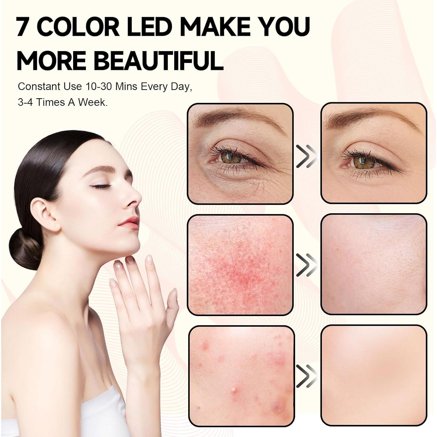 Lámpara de Terapia de Luz Roja Shyineyou 30W 7 Colores