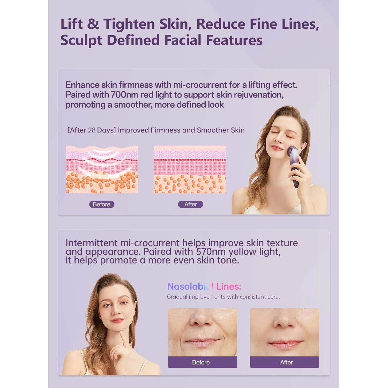 Dispositivo Facial 6-en-1 Yuonry Antienvejecimiento Púrpura