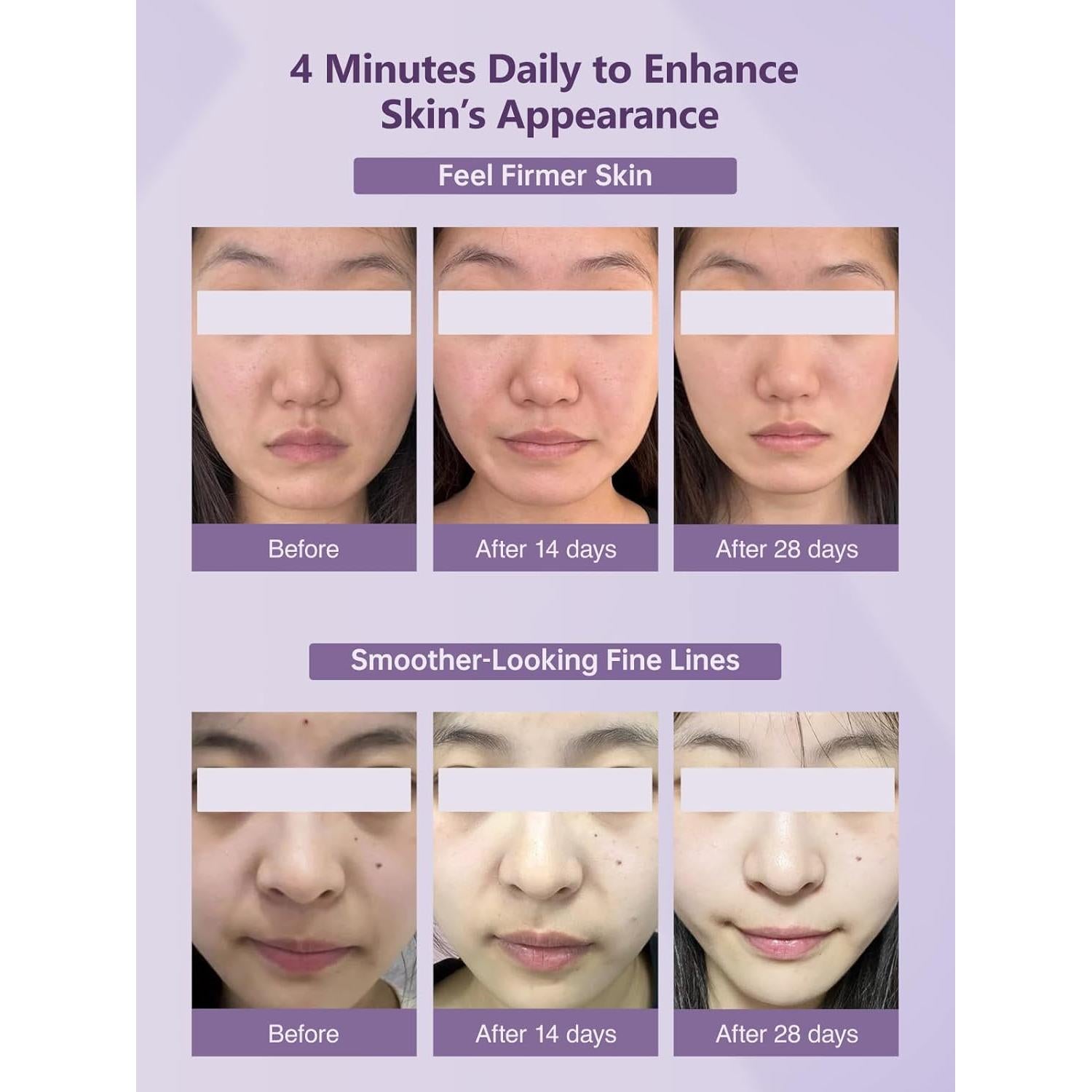 Dispositivo Facial 6-en-1 Yuonry Antienvejecimiento Púrpura