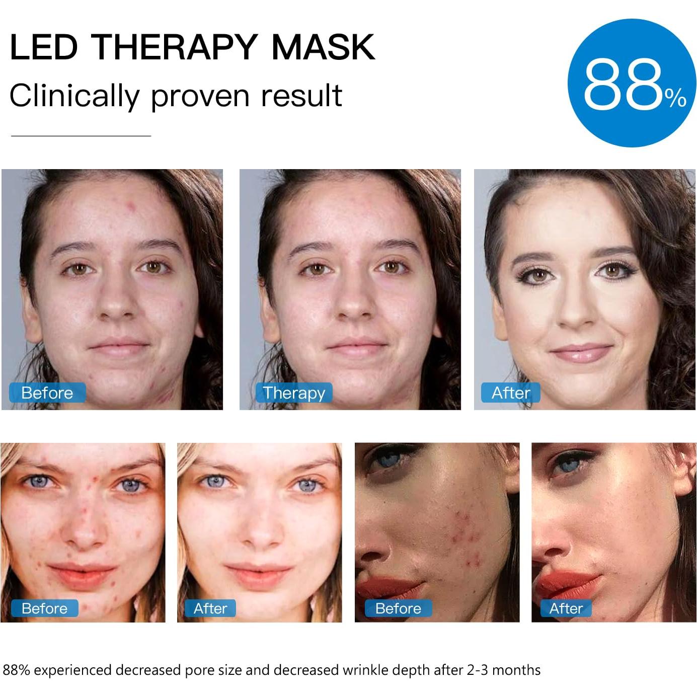 Máscara Facial LED IOBTY Terapia de Luz 7 Colores Recargable