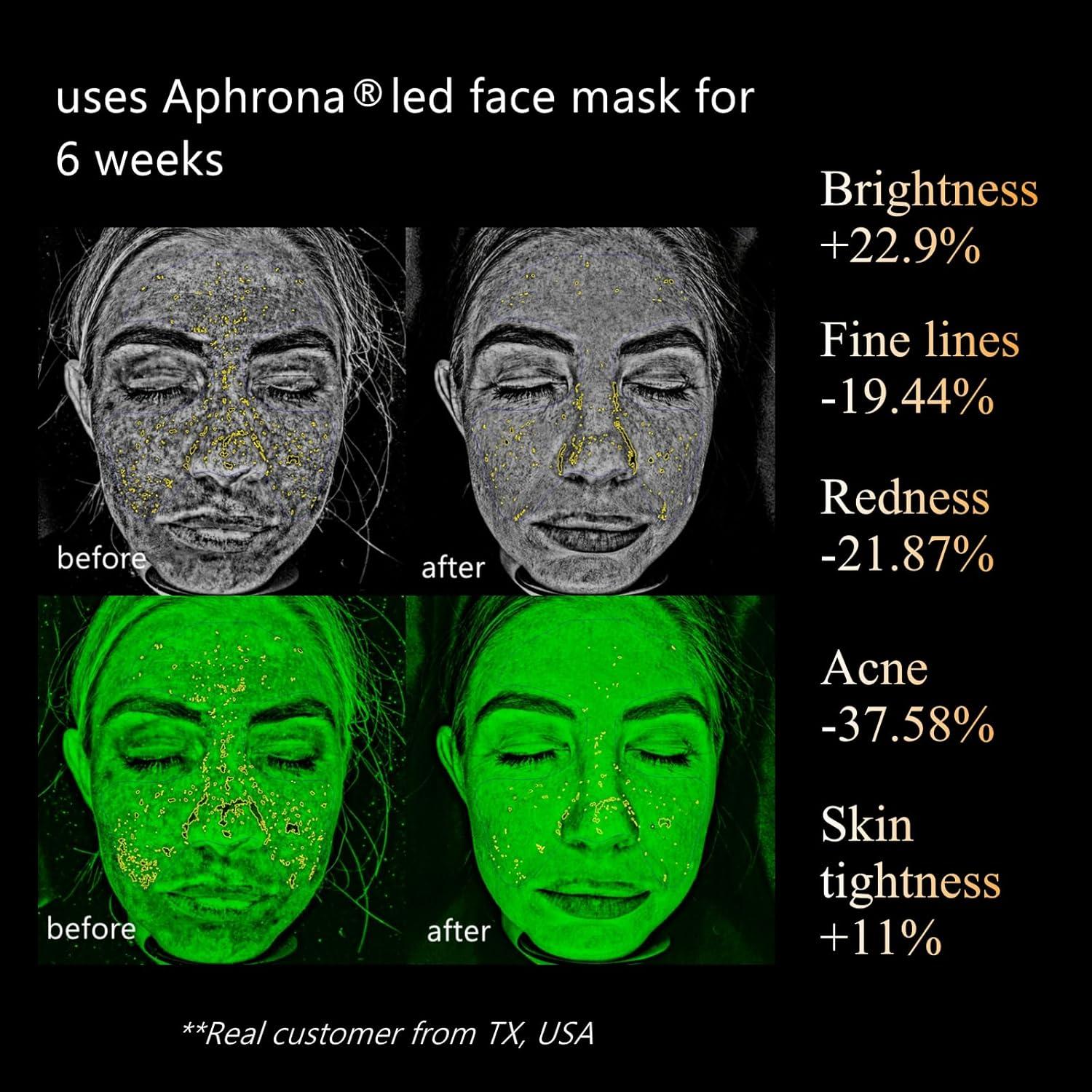 Máscara Facial LED Aphrona Halo para Acné y Arrugas
