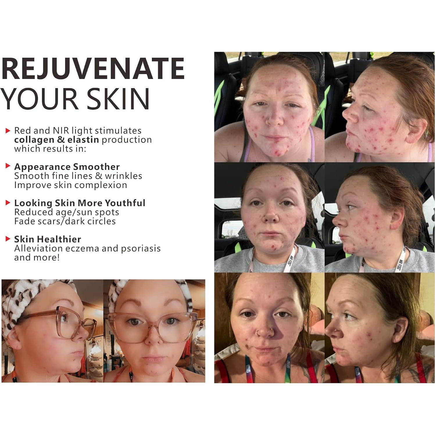 Panel de Terapia de Luz Roja Supersred 60 LEDs Doble Chip