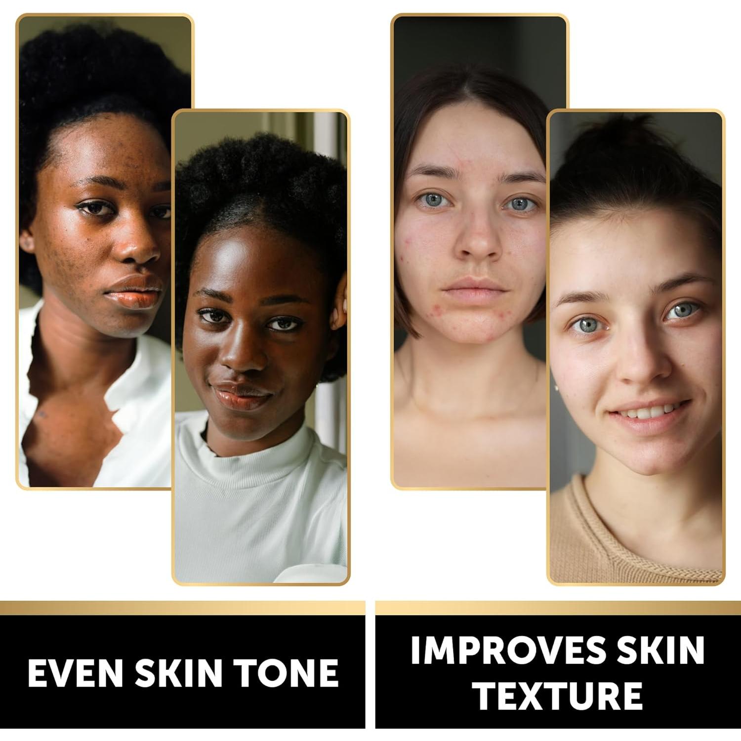 Jabón Negro de Carbón y Ácido Kójico Valitic - 2 Unidades