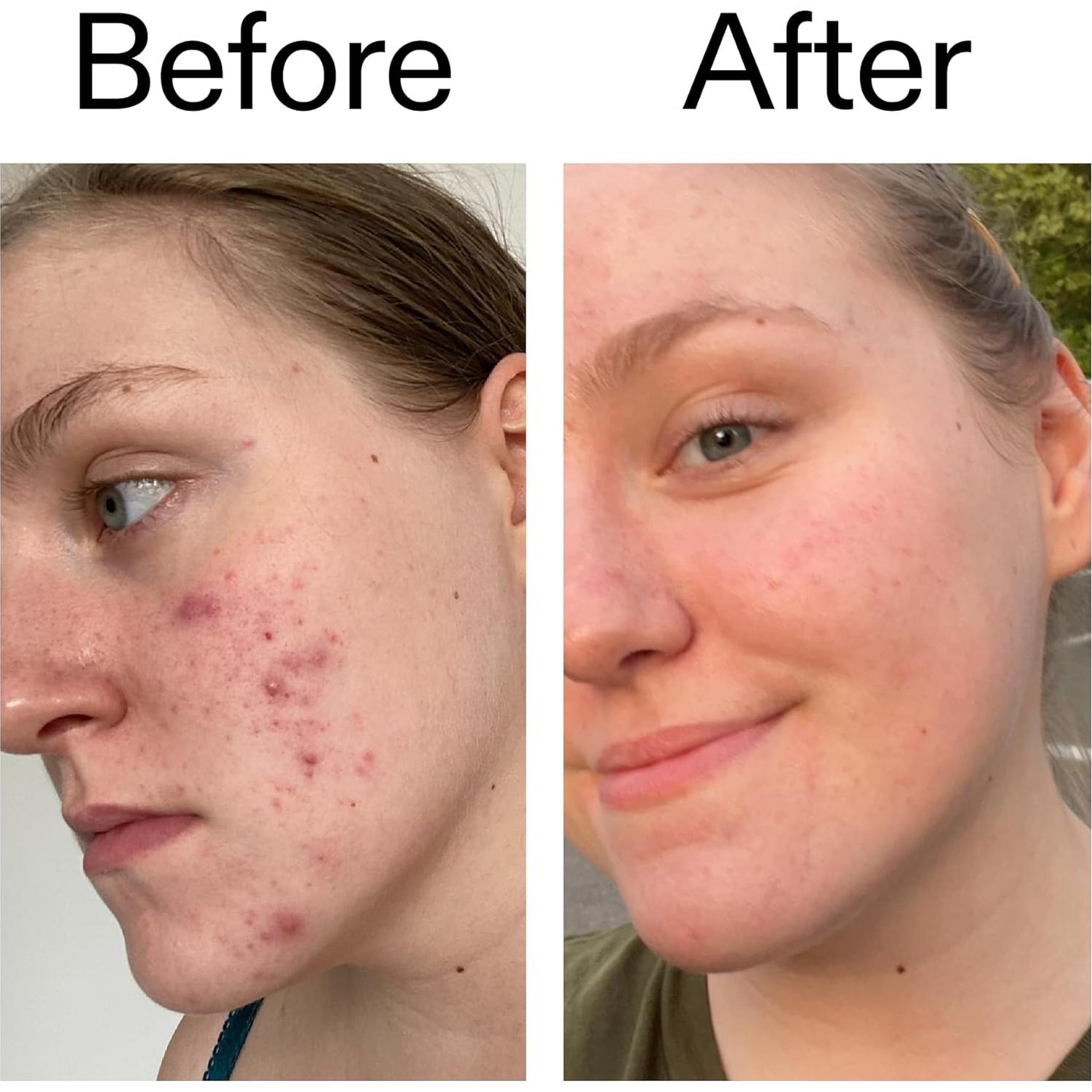 Tónico Exfoliante Ácido Glicólico 10% El INKEY List 100 ml