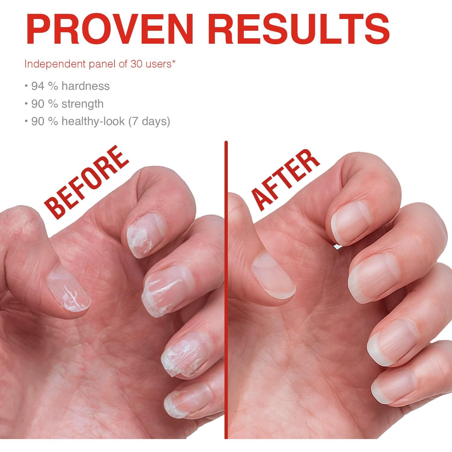 Endurecedor de Uñas ProBelle 14g - Tratamiento Reparador Transparente