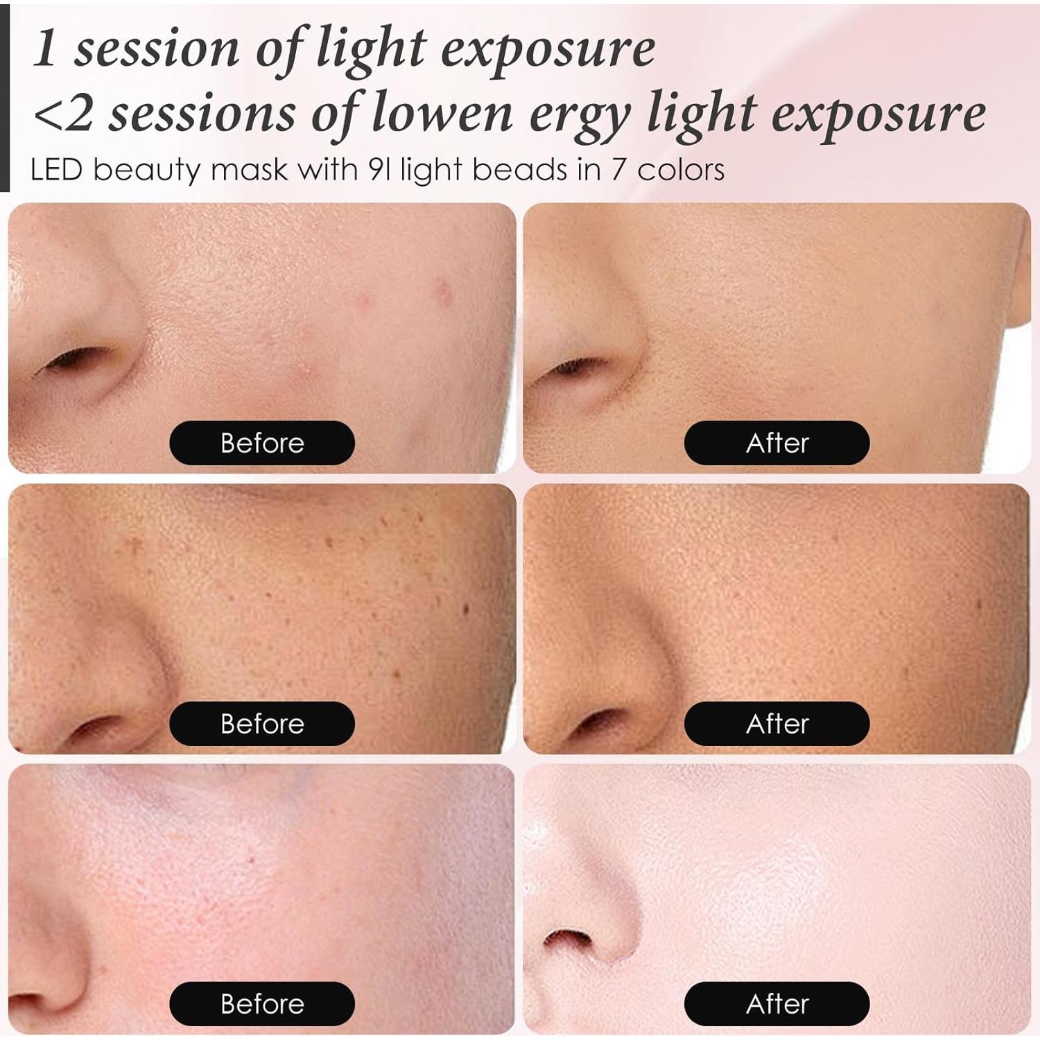 Máscara Facial LED 7 Colores Sunpint Terapia Luz Roja