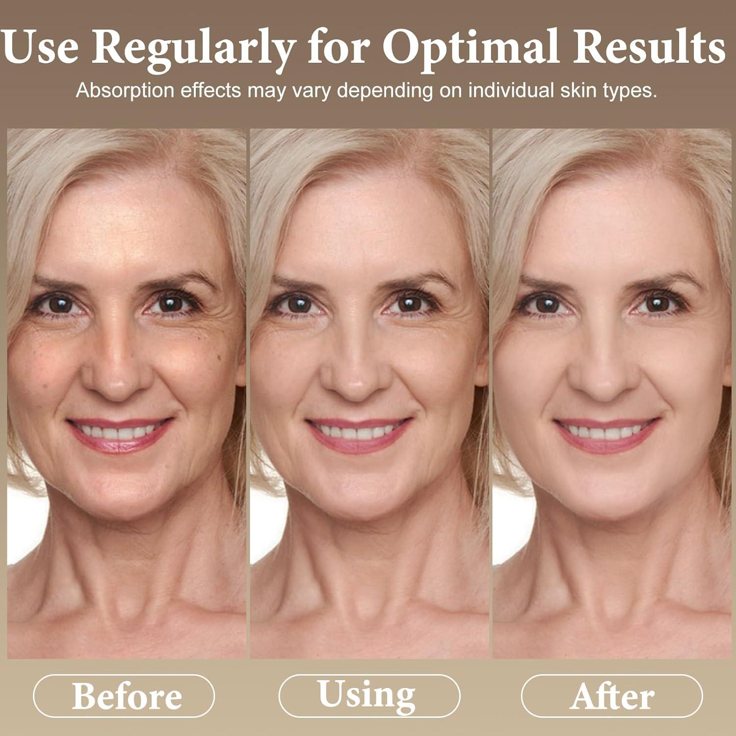 Mascarilla Facial ISTON 6 Piezas Colágeno Hidratante