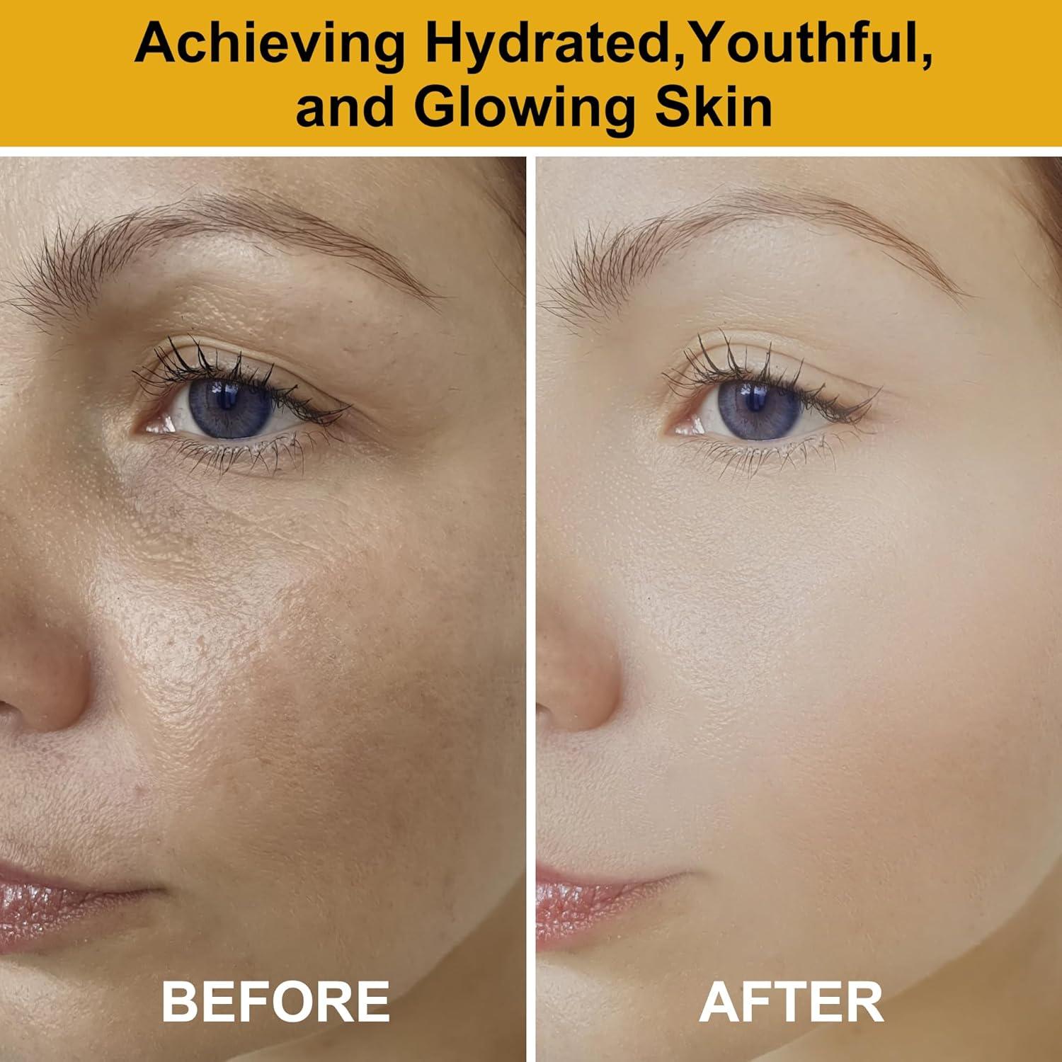 Set de Cuidado de la Piel DOYEEWO Hidratante y Antienvejecimiento