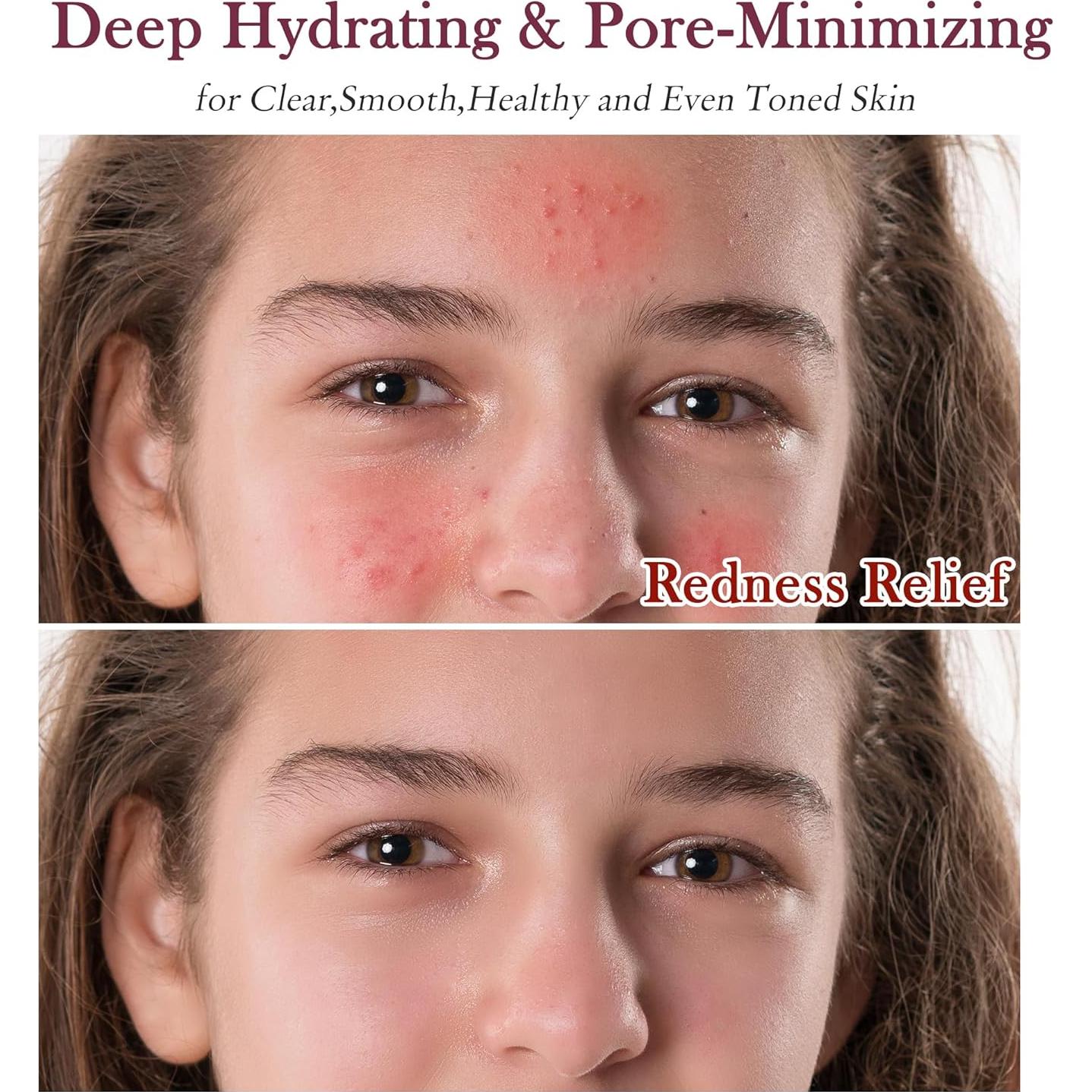 Kit Cuidado Facial GEBEATY Minimiza Poros Hidratante 22x17cm