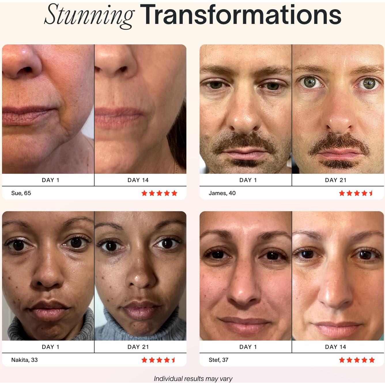 Varita Facial Solawave 4 en 1 | Terapia Luz Roja