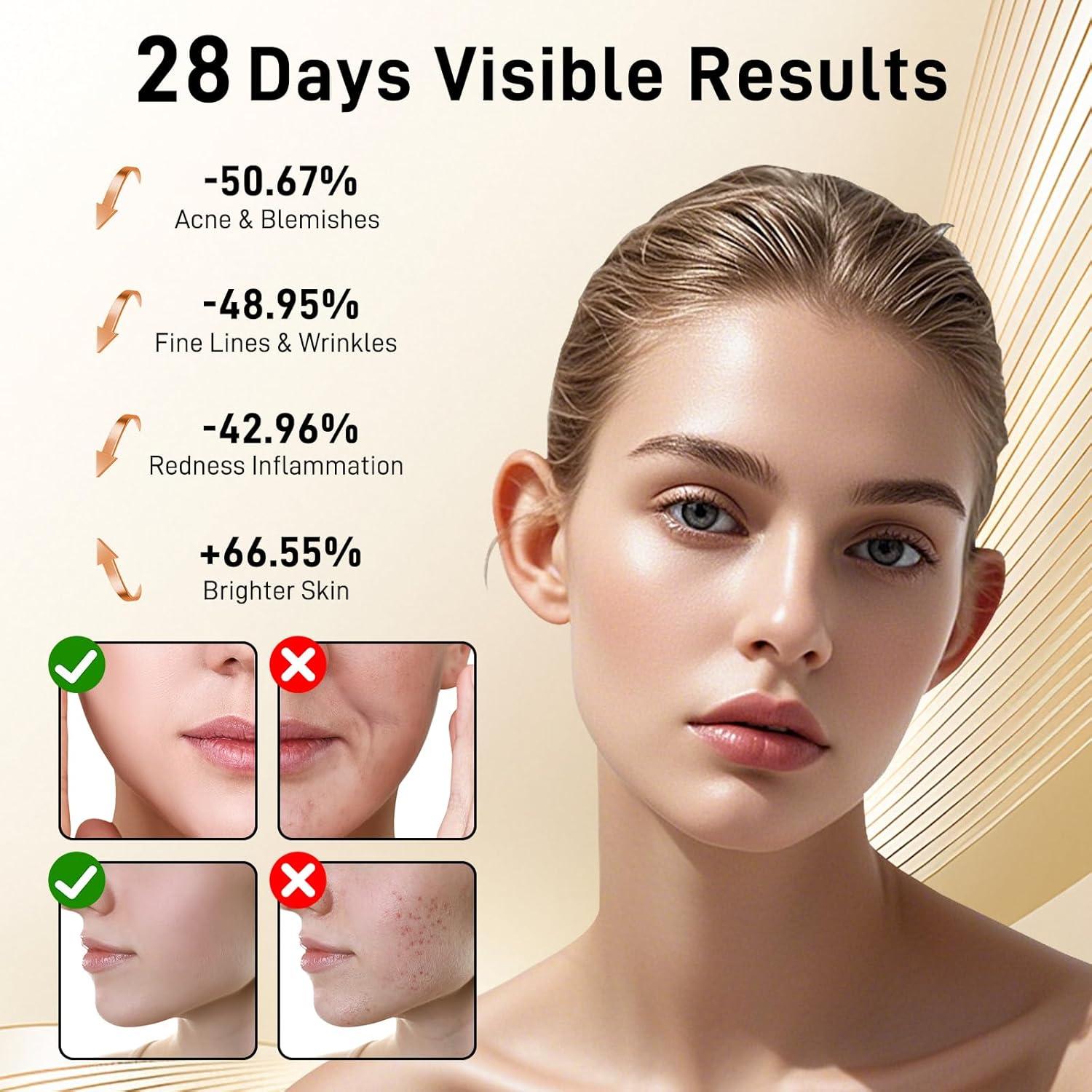 Red Light Therapy for Face, Enhance LED Face Mask Light Therapy for Acne, Wrinkles & Skin Rejuvenation, 3 Light Modes & Timing Settings, Eye Protection, Portable LED Face Mask Home Skincare