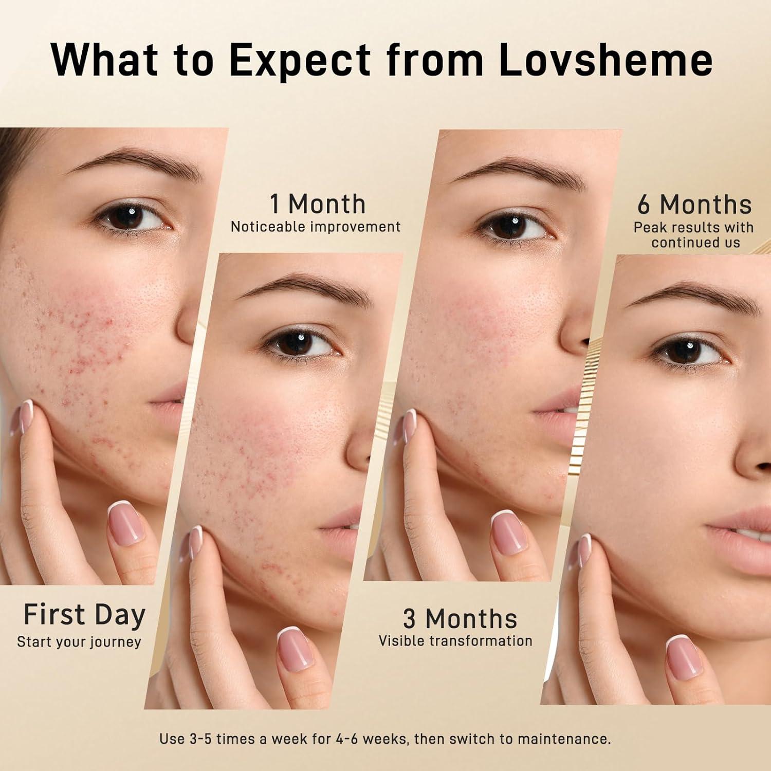 Red Light Therapy for Face, Enhance LED Face Mask Light Therapy for Acne, Wrinkles & Skin Rejuvenation, 3 Light Modes & Timing Settings, Eye Protection, Portable LED Face Mask Home Skincare