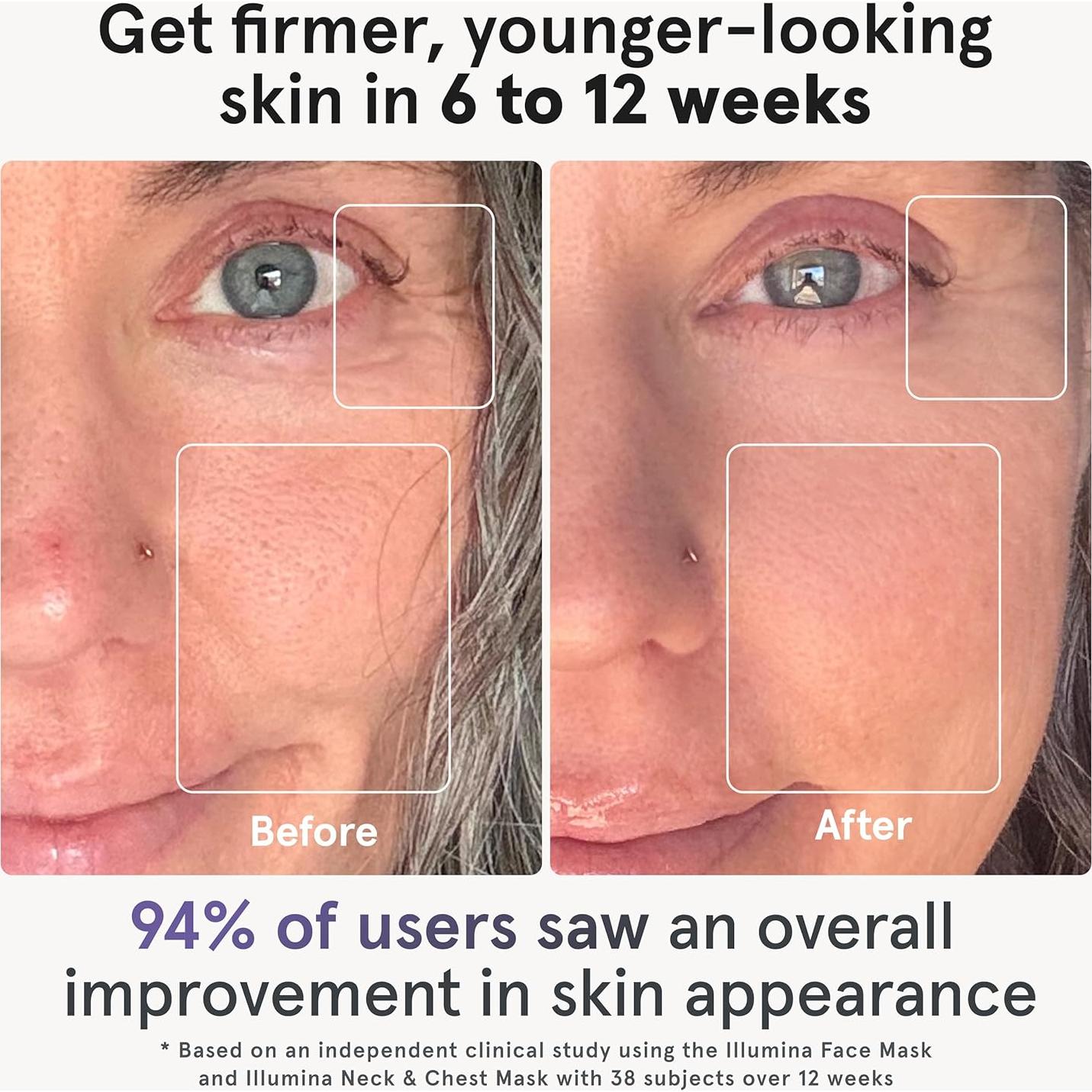 Máscara Facial LED iRestore Antienvejecimiento 360 LEDs