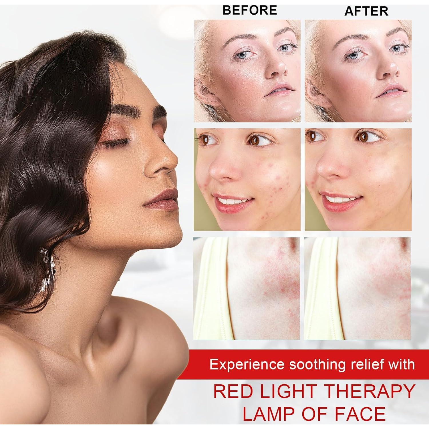 Lámpara Terapia Luz Roja Beautiebeam 150W Ajustable 590-940nm