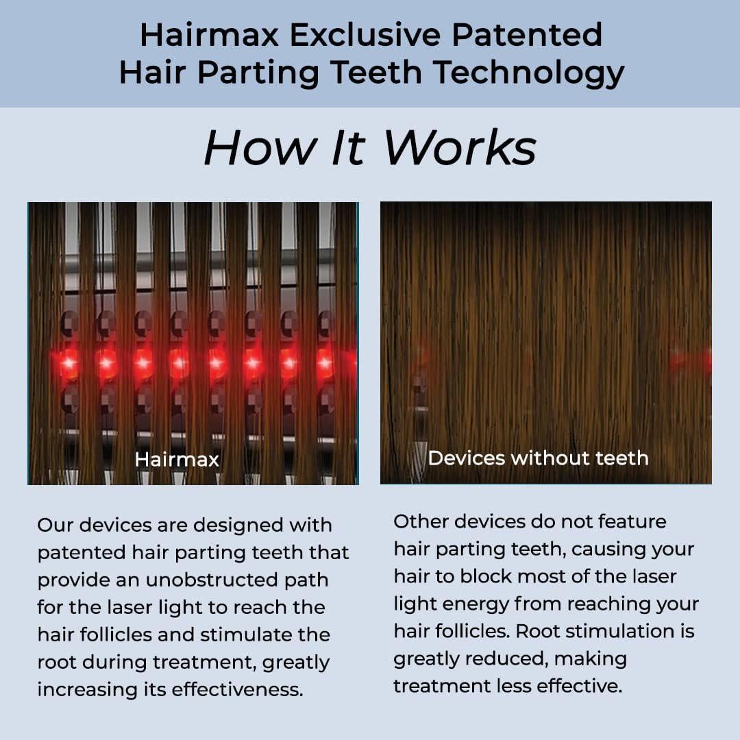 Hairmax Ultima 12 LaserComb - Tratamiento Capilar Inalámbrico