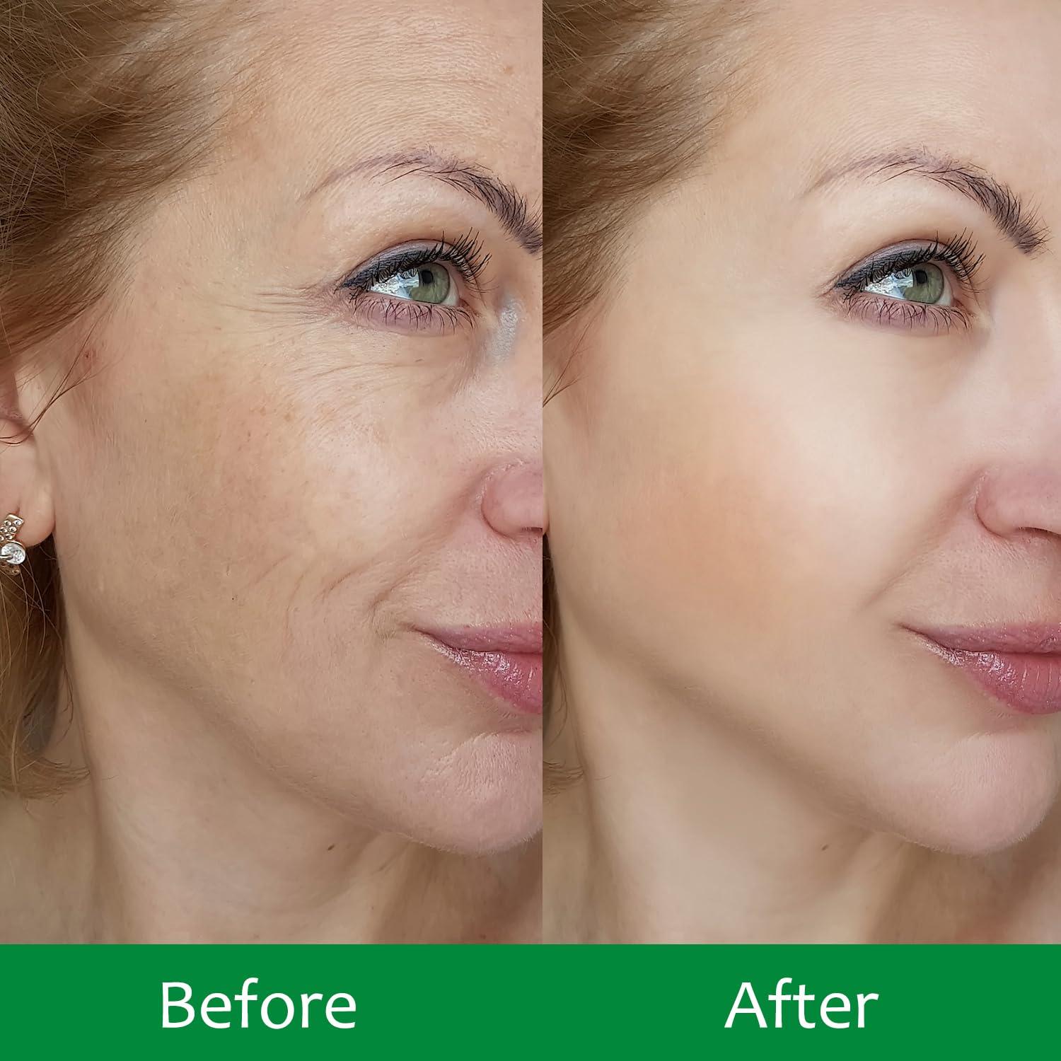 Mascarillas Faciales IREV Hidratantes 10 Piezas Antiarrugas