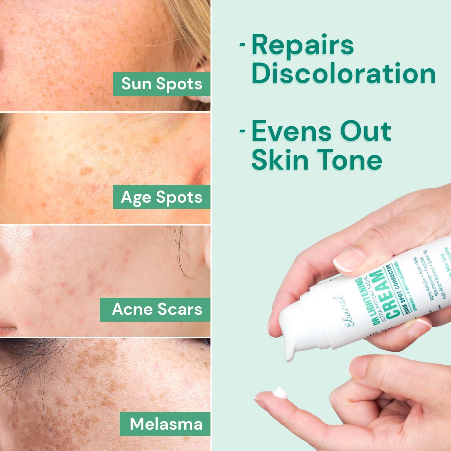 Crema Despigmentante Ebanel 42g para Manchas Oscuras